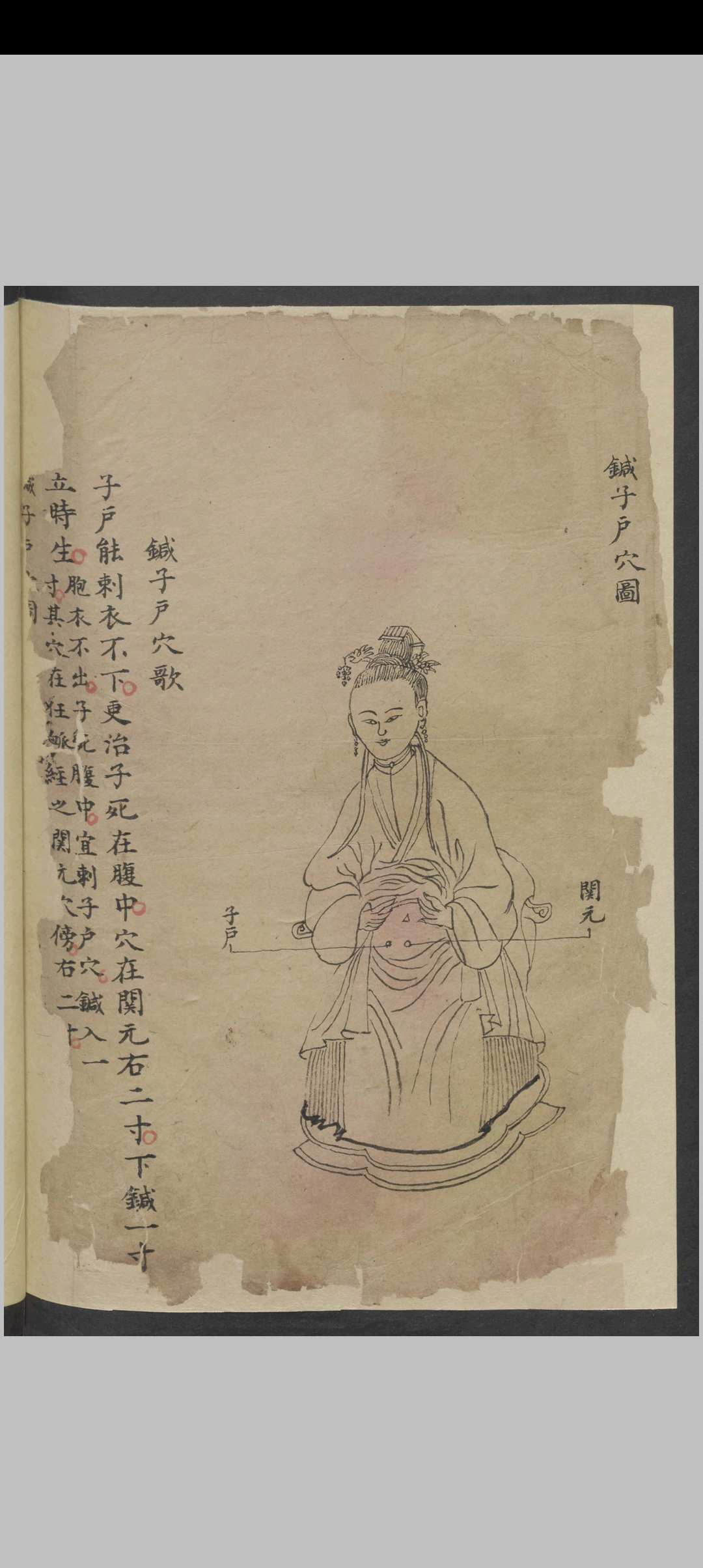 图片[29]中华古籍网-专注古书收集针灸经络汇抄 , 1900中华古籍网-专注古书收集中华古籍网