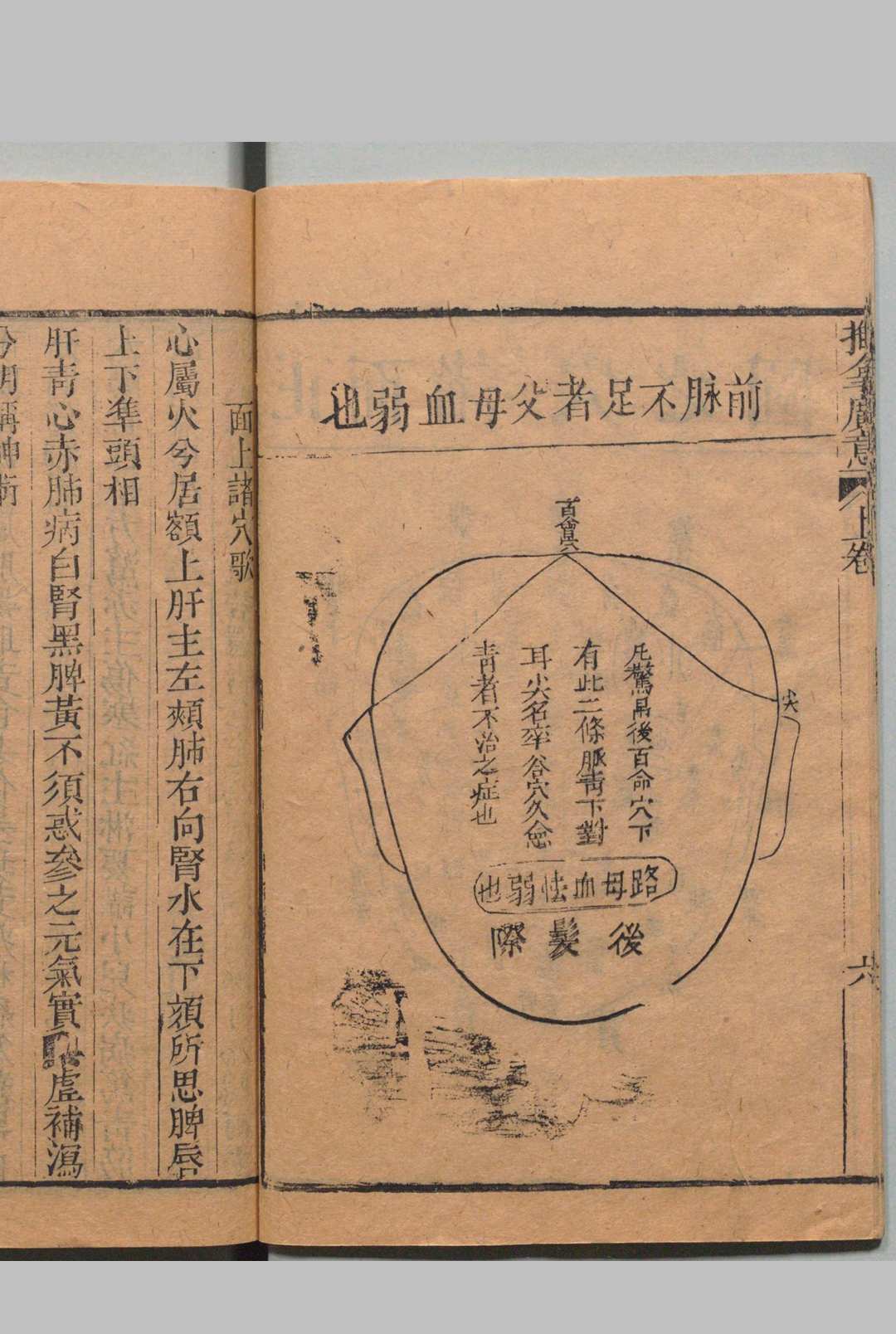 图片[7]中华古籍网-专注古书收集推拿广意 ３卷 熊应雄 陈世凯 清道光12年中华古籍网-专注古书收集中华古籍网