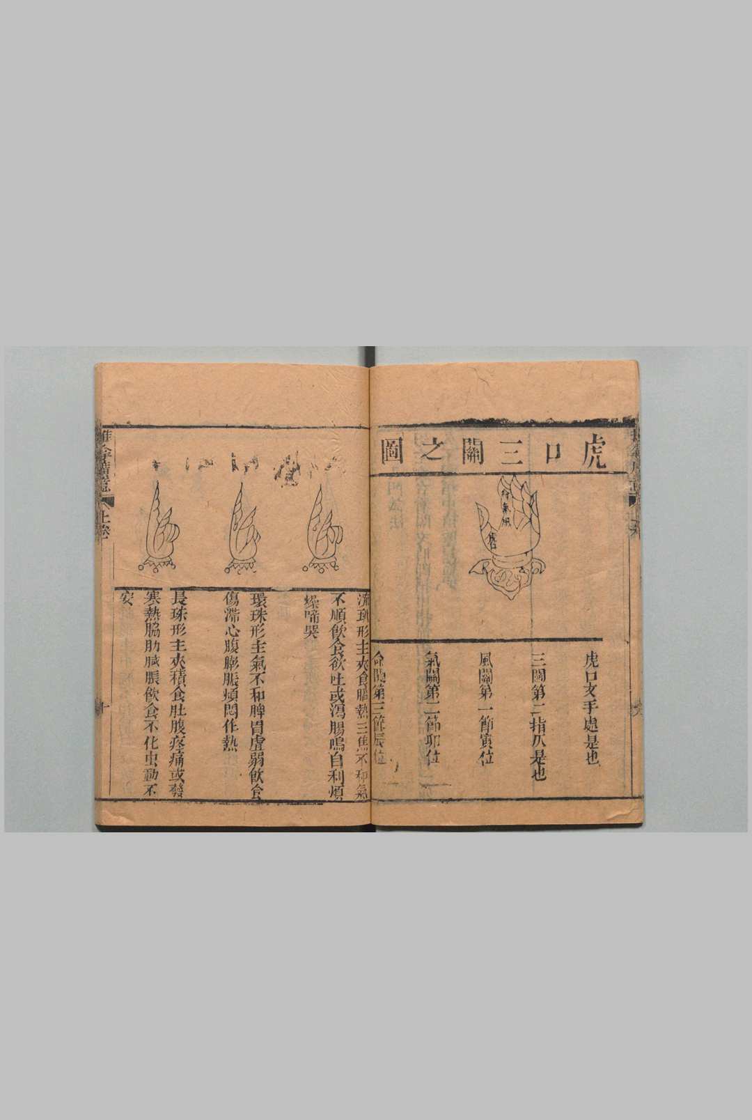 图片[12]中华古籍网-专注古书收集推拿广意 ３卷 熊应雄 陈世凯 清道光12年中华古籍网-专注古书收集中华古籍网