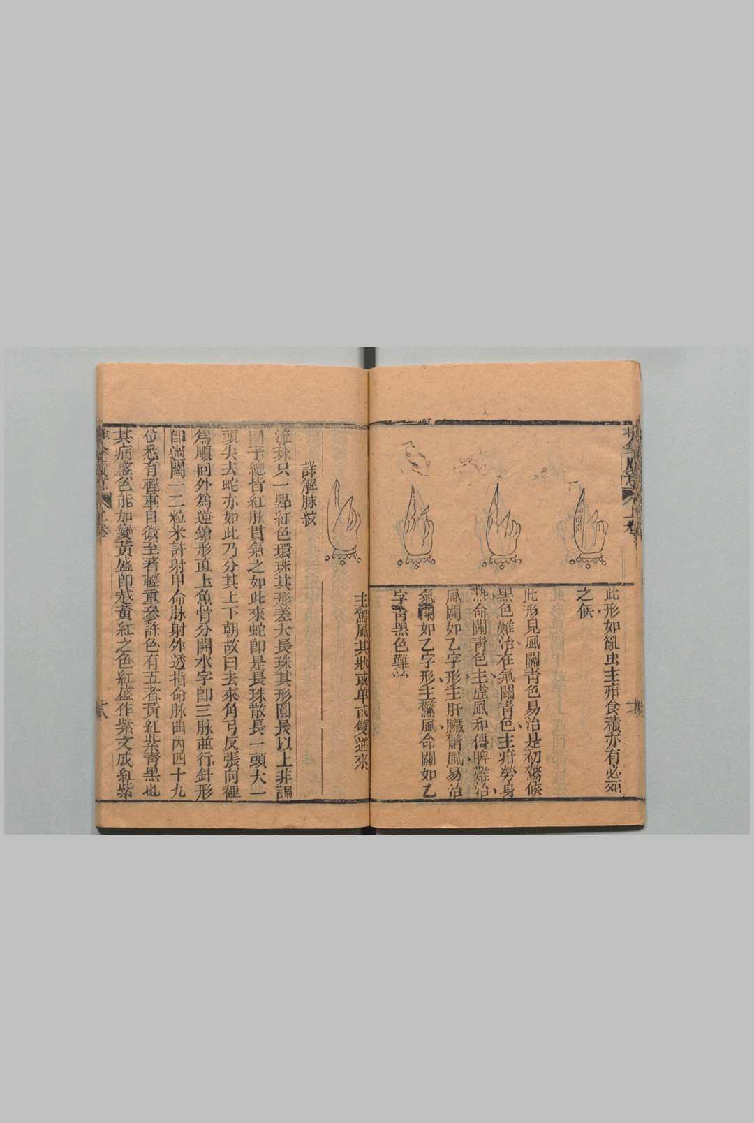 图片[11]中华古籍网-专注古书收集推拿广意 ３卷 熊应雄 陈世凯 清道光12年中华古籍网-专注古书收集中华古籍网