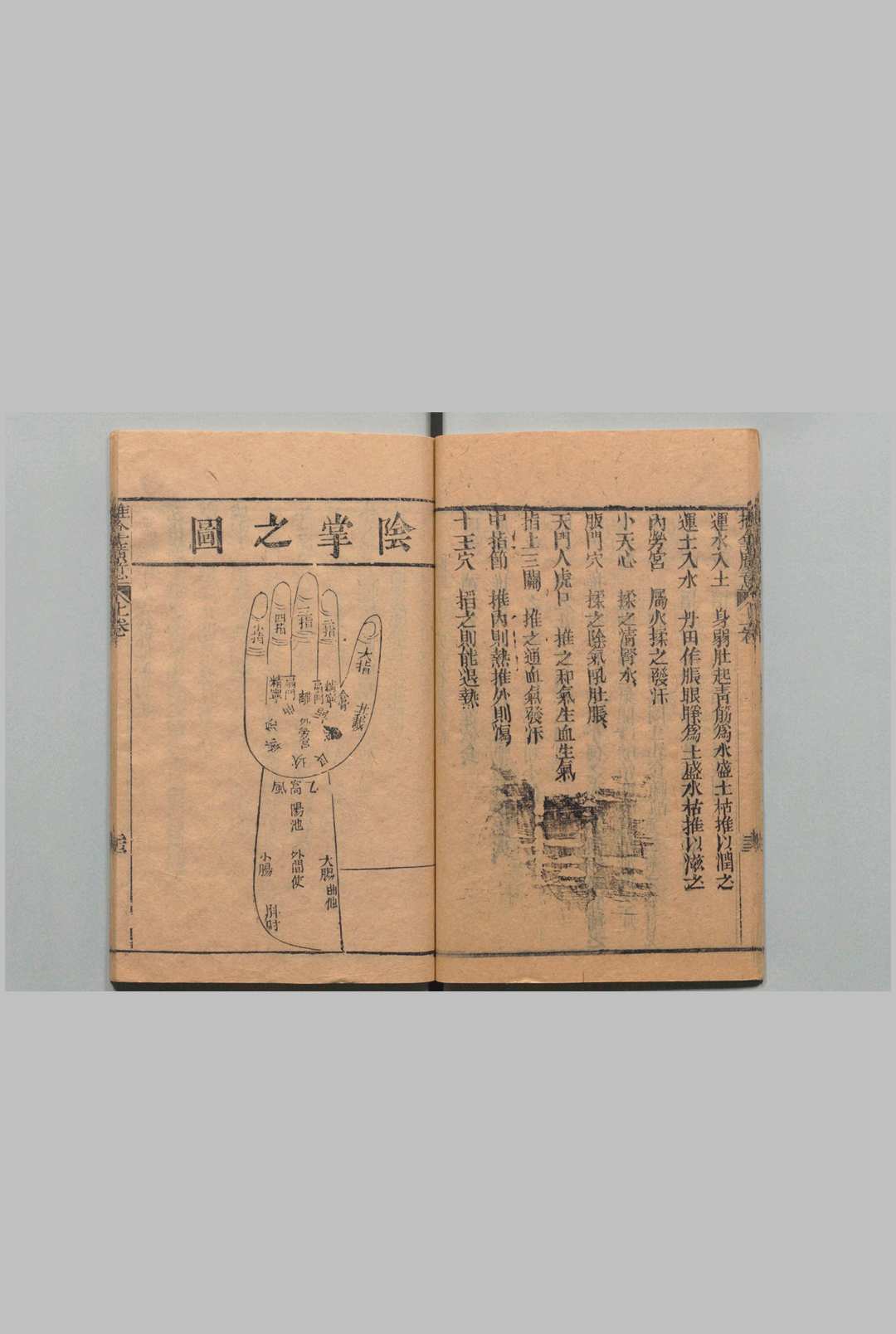 图片[13]中华古籍网-专注古书收集推拿广意 ３卷 熊应雄 陈世凯 清道光12年中华古籍网-专注古书收集中华古籍网