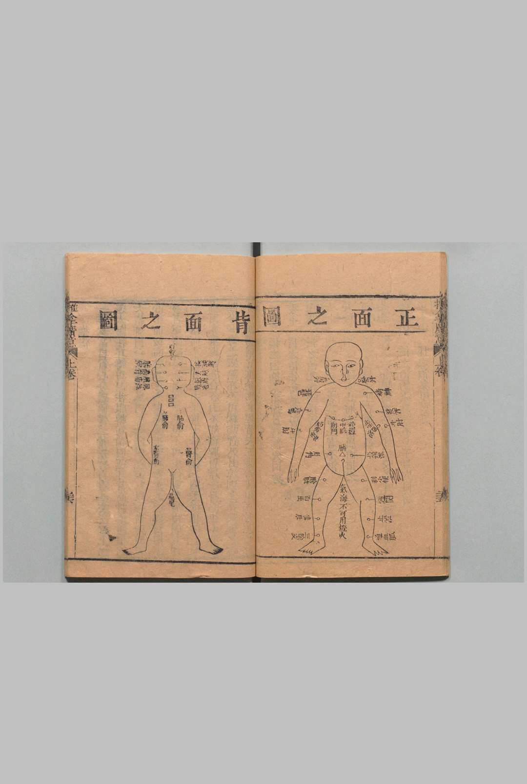 图片[8]中华古籍网-专注古书收集推拿广意 ３卷 熊应雄 陈世凯 清道光12年中华古籍网-专注古书收集中华古籍网