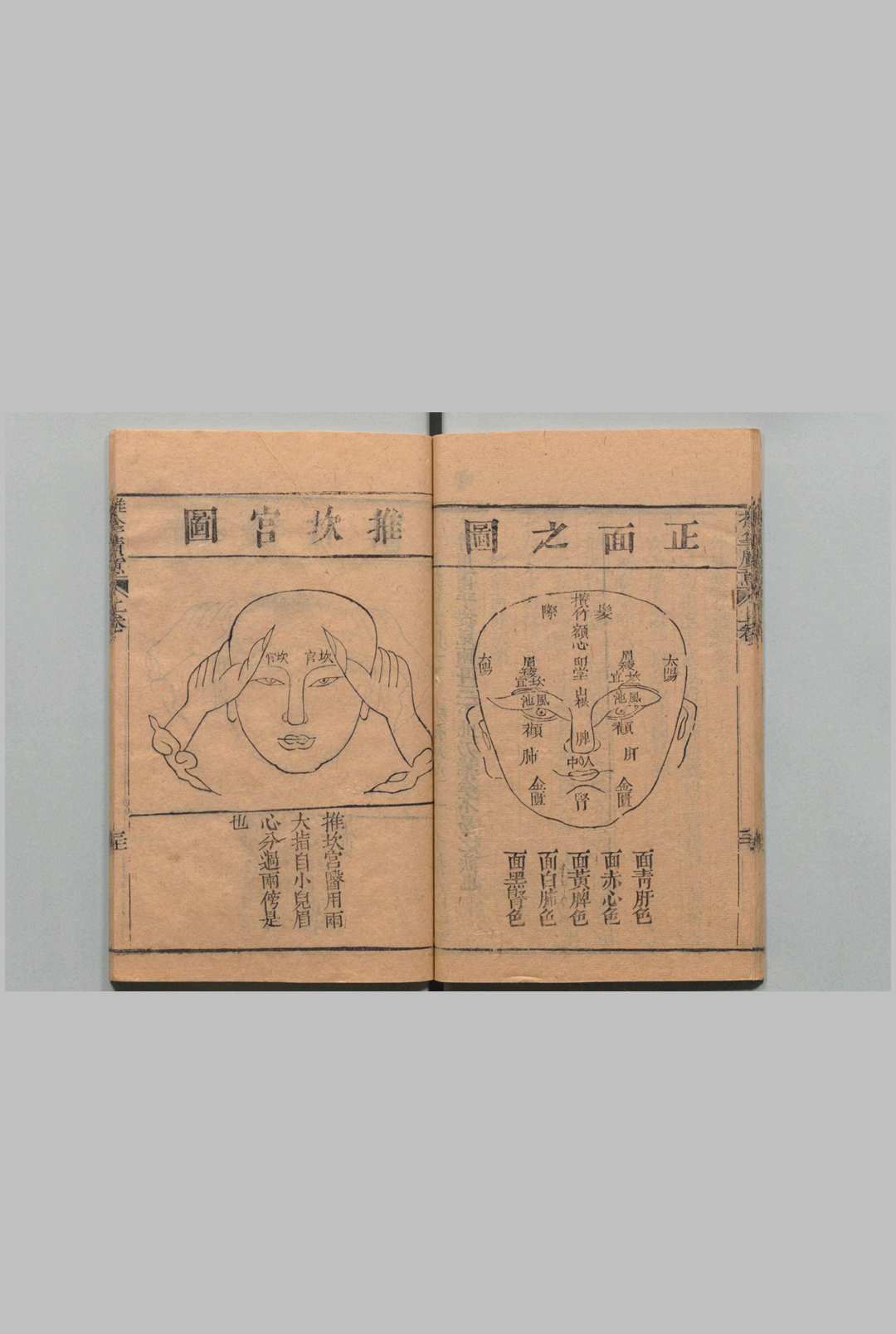 图片[15]中华古籍网-专注古书收集推拿广意 ３卷 熊应雄 陈世凯 清道光12年中华古籍网-专注古书收集中华古籍网