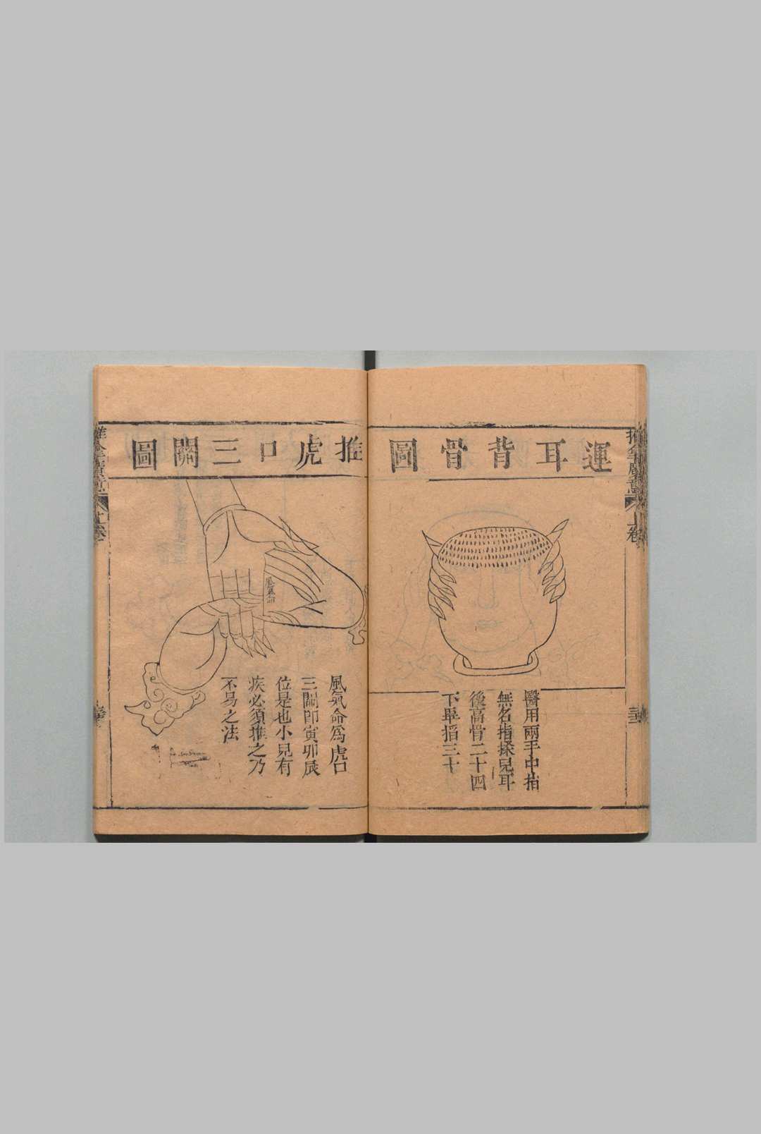 图片[16]中华古籍网-专注古书收集推拿广意 ３卷 熊应雄 陈世凯 清道光12年中华古籍网-专注古书收集中华古籍网