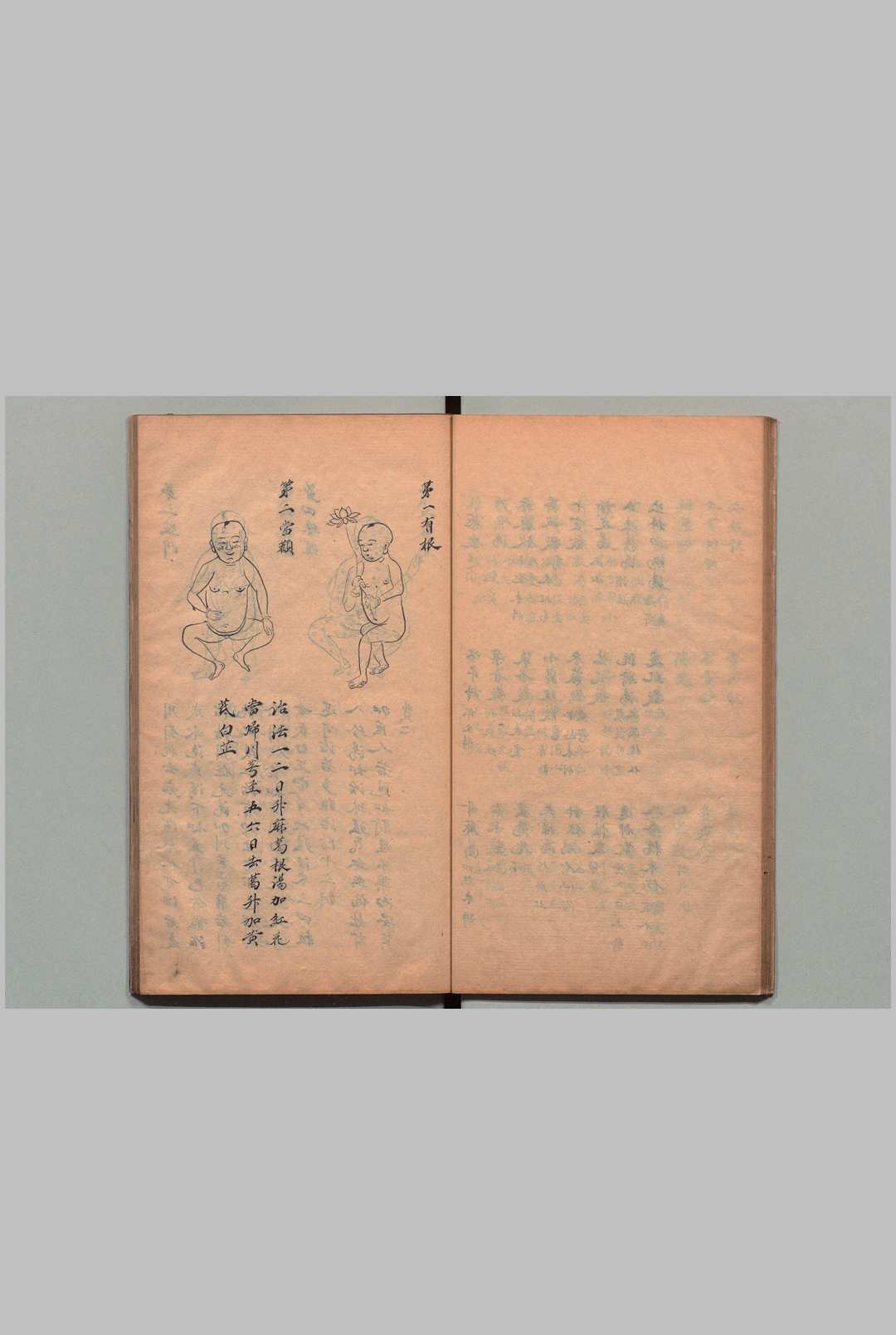 图片[7]中华古籍网-专注古书收集济人宝笈 ２卷 刘晓（清）写本 ,江户中华古籍网-专注古书收集中华古籍网