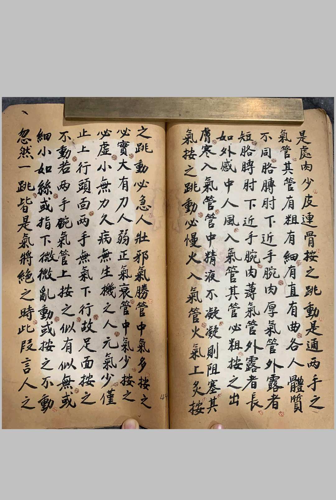 图片[13]中华古籍网-专注古书收集《辨损伤痨病诀》中华古籍网-专注古书收集中华古籍网