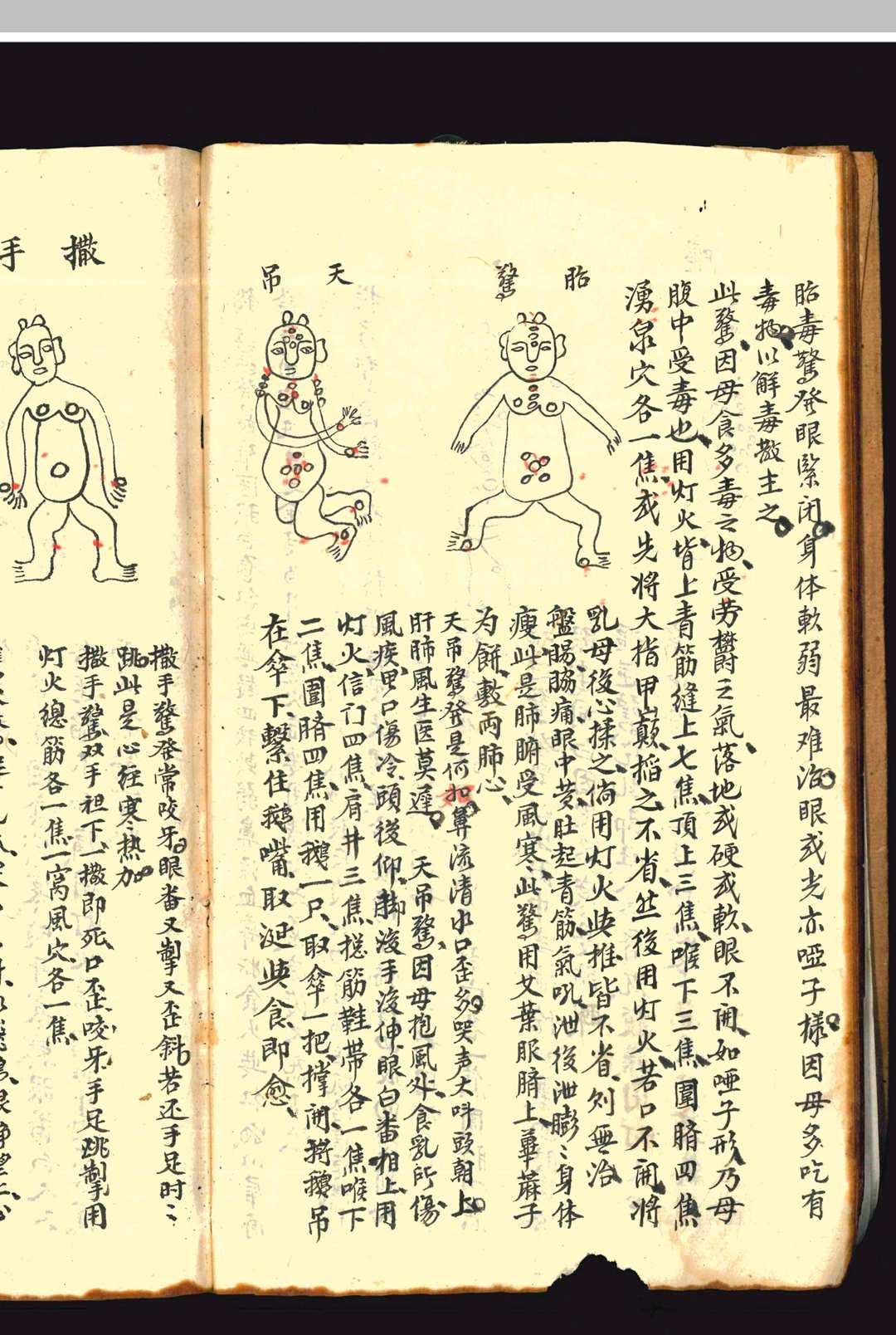 图片[12]中华古籍网-专注古书收集《祖传秘授奇方》上下册中华古籍网-专注古书收集中华古籍网