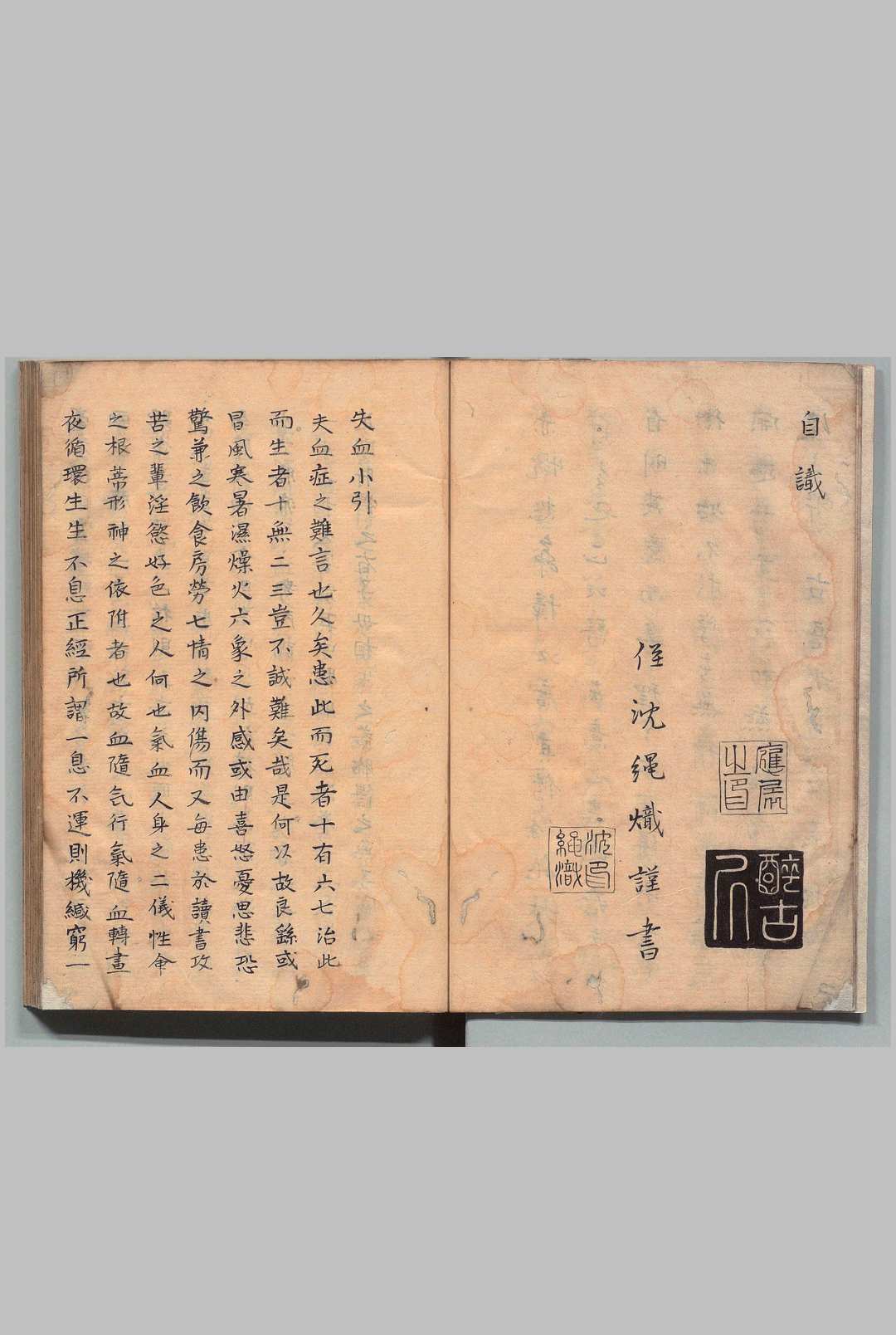 图片[2]中华古籍网-专注古书收集血症全集 孙光裕（明） 写本 ,江户中华古籍网-专注古书收集中华古籍网