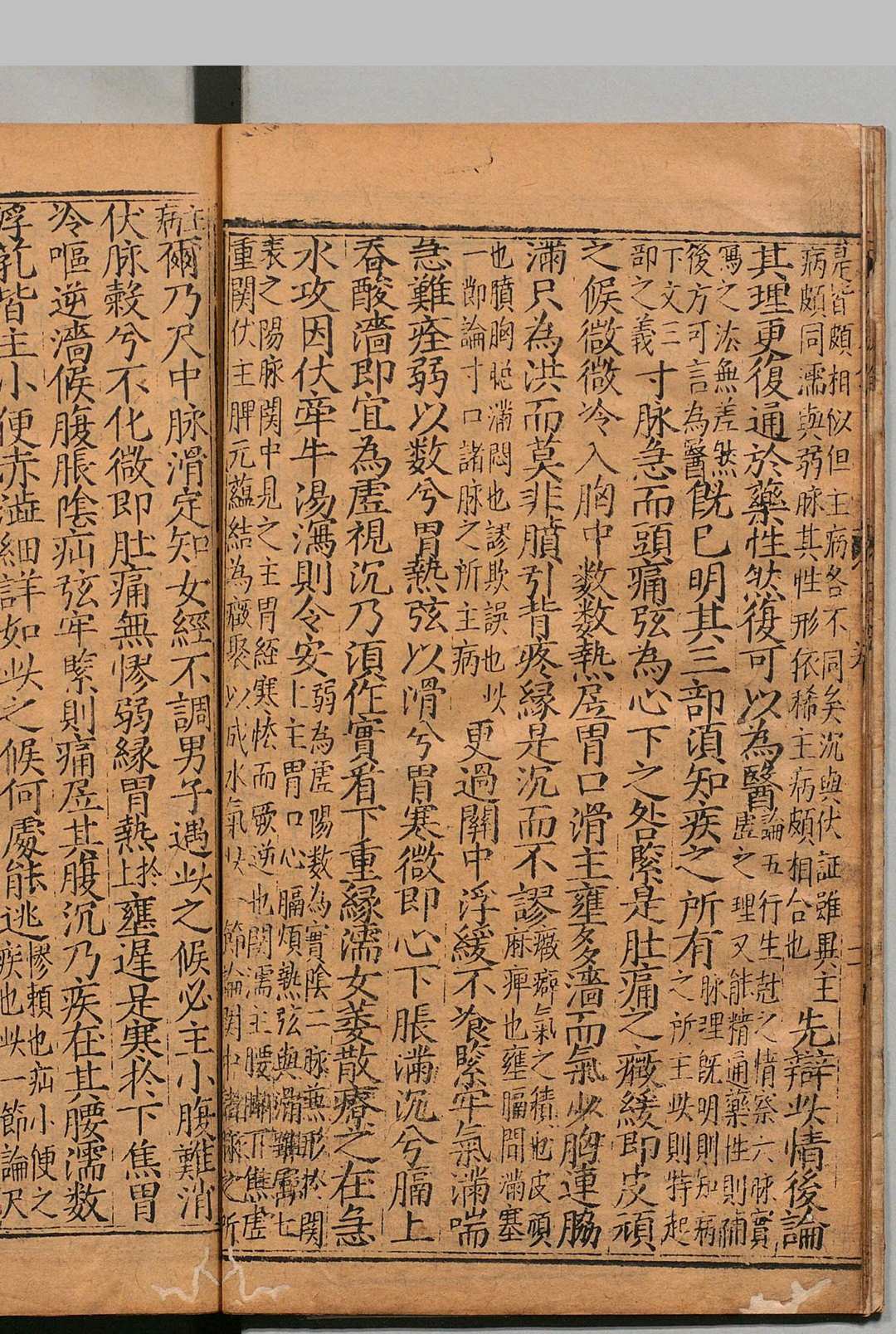 图片[6]中华古籍网-专注古书收集锓图注王叔和脉诀大全 ５卷 张世贤  明刊本中华古籍网-专注古书收集中华古籍网