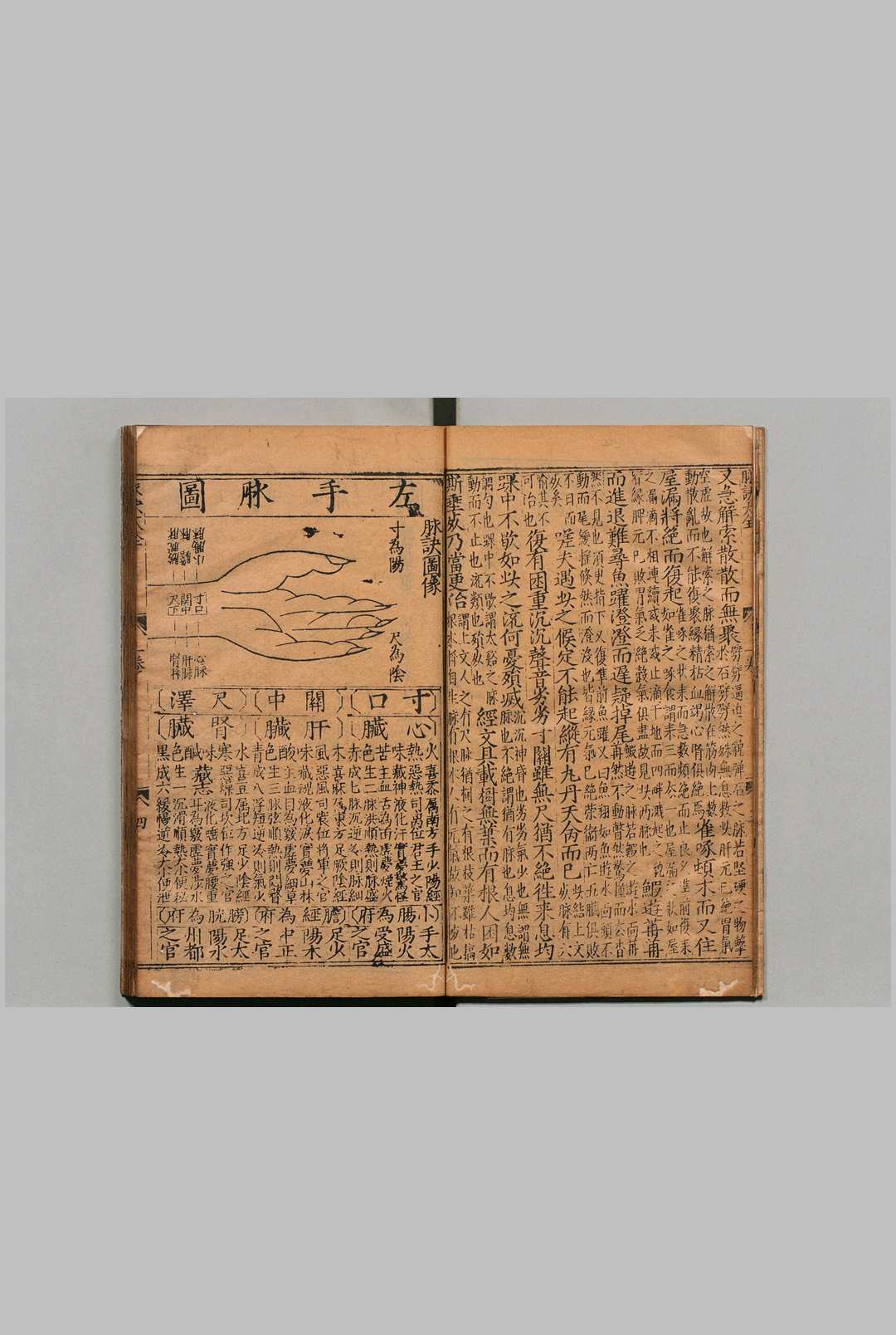 图片[5]中华古籍网-专注古书收集锓图注王叔和脉诀大全 ５卷 张世贤  明刊本中华古籍网-专注古书收集中华古籍网