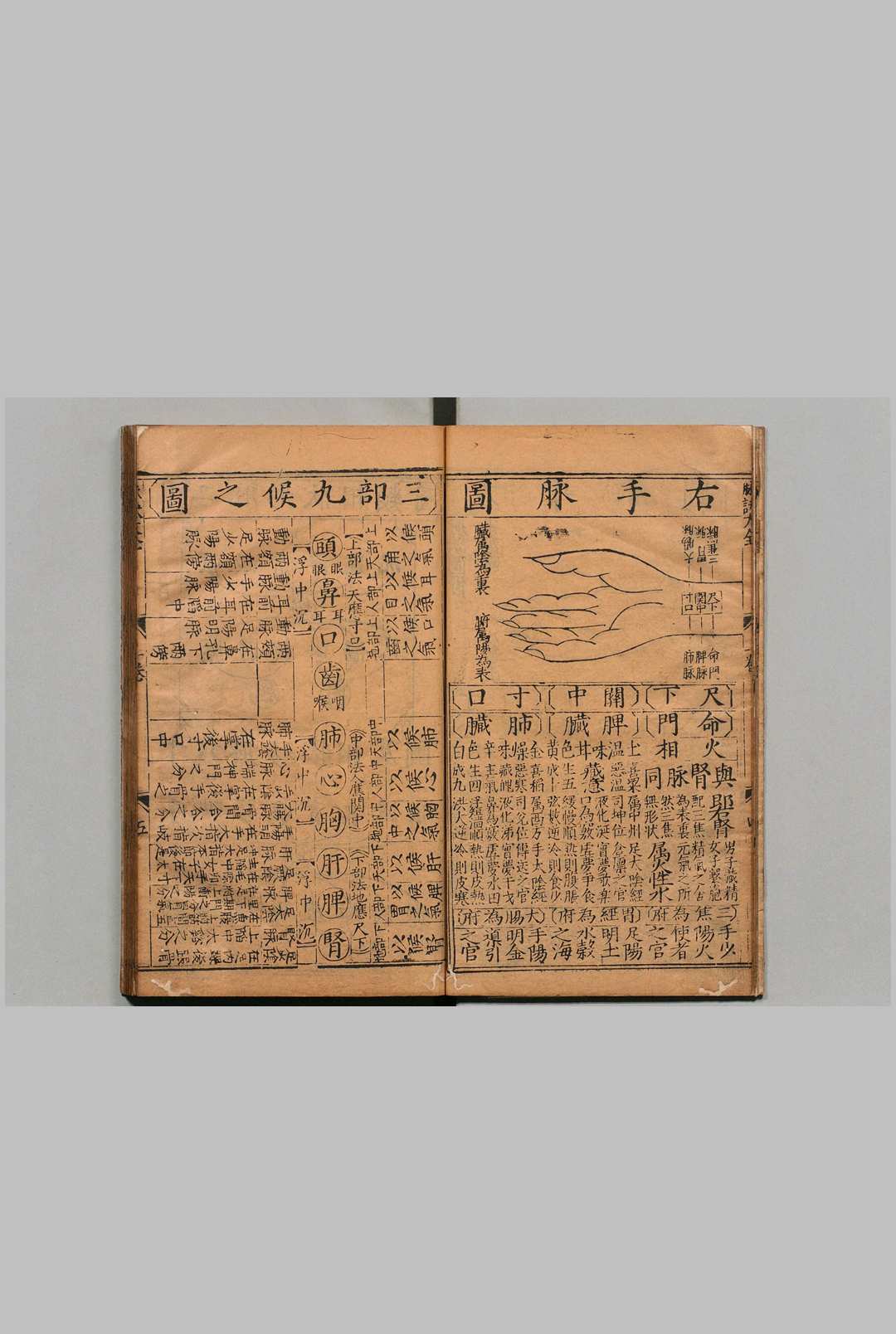 图片[4]中华古籍网-专注古书收集锓图注王叔和脉诀大全 ５卷 张世贤  明刊本中华古籍网-专注古书收集中华古籍网
