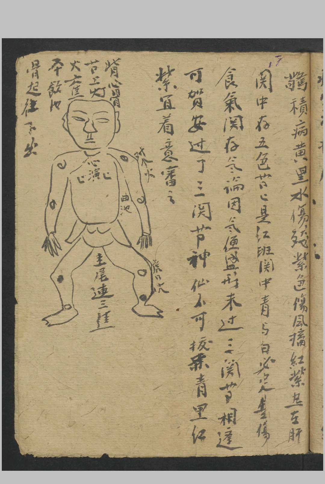 图片[13]中华古籍网-专注古书收集姚翼云 小儿诸症方 , 1945中华古籍网-专注古书收集中华古籍网