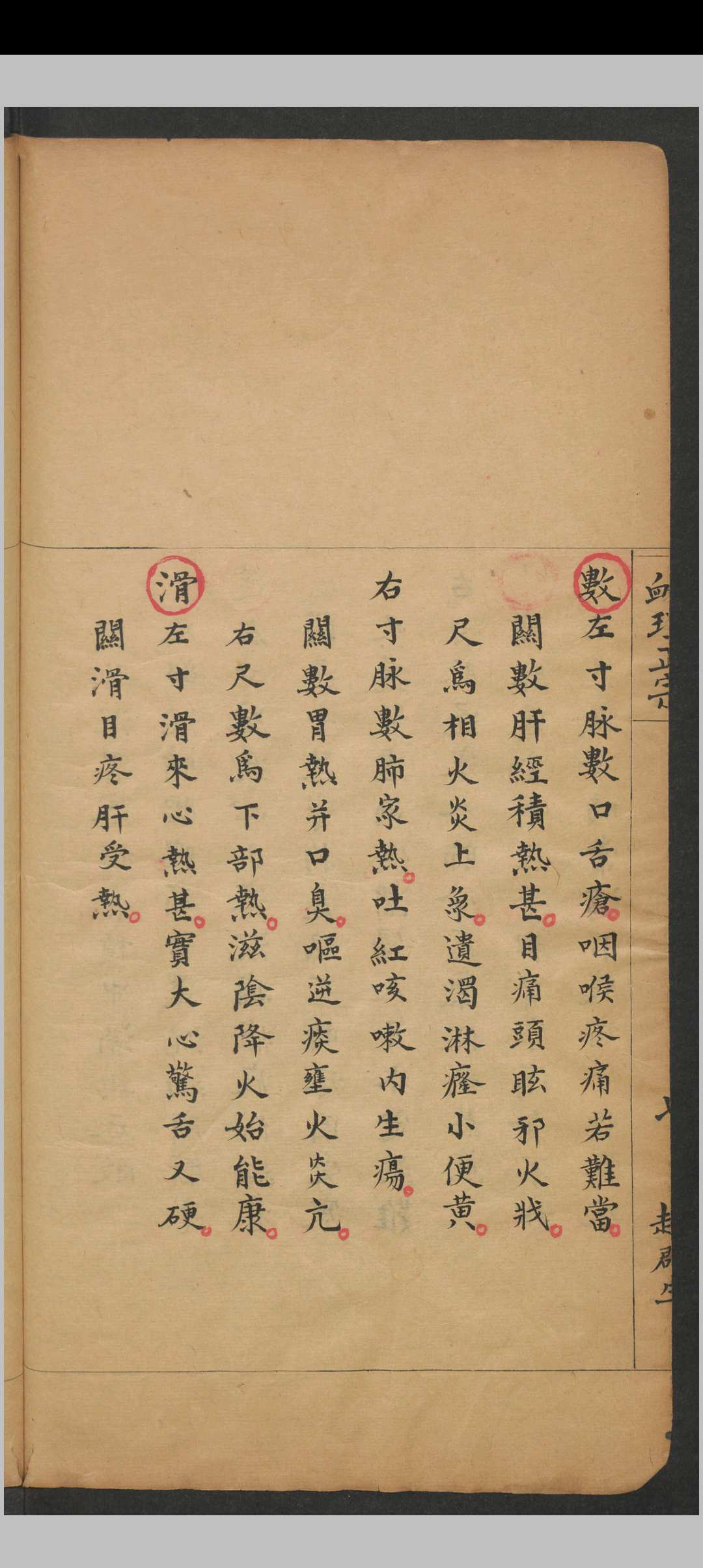 图片[7]中华古籍网-专注古书收集脉理正宗.[清乾隆]郎毓純参辑.清光绪二十四年赵群生抄本中华古籍网-专注古书收集中华古籍网