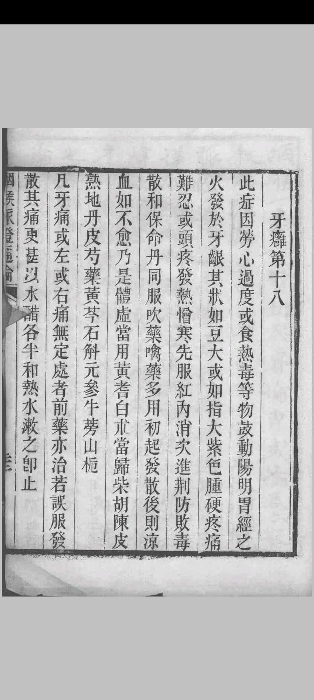 图片[10]中华古籍网-专注古书收集咽喉脉证通论 传为宗杭州千佛寺僧人著 1827中华古籍网-专注古书收集中华古籍网