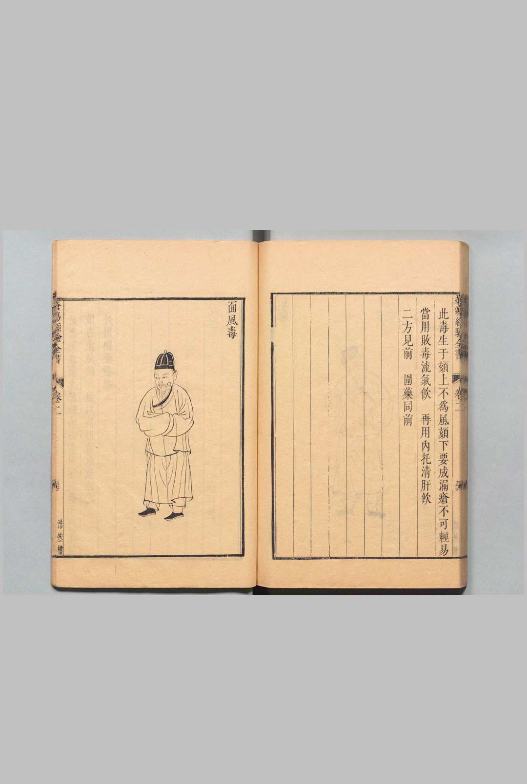 图片[7]中华古籍网-专注古书收集疮疡经验全书 13卷 窦汉卿（宋）洪瞻严（清）陈友恭（清）清康熙56年 , 浩然楼中华古籍网-专注古书收集中华古籍网