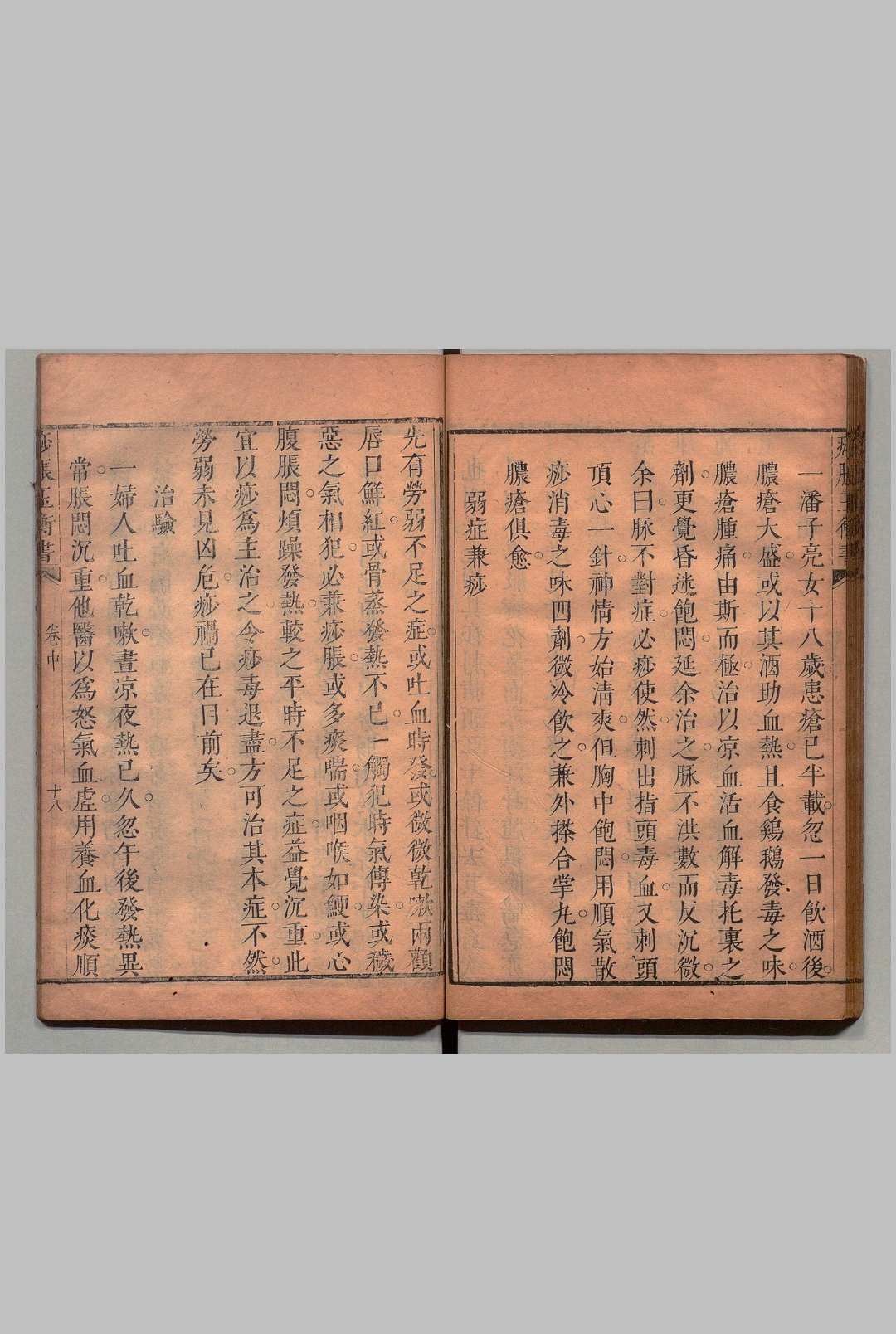 图片[6]中华古籍网-专注古书收集痧胀玉衡书 ３卷 后１卷  郭志邃,清康熙14年中华古籍网-专注古书收集中华古籍网