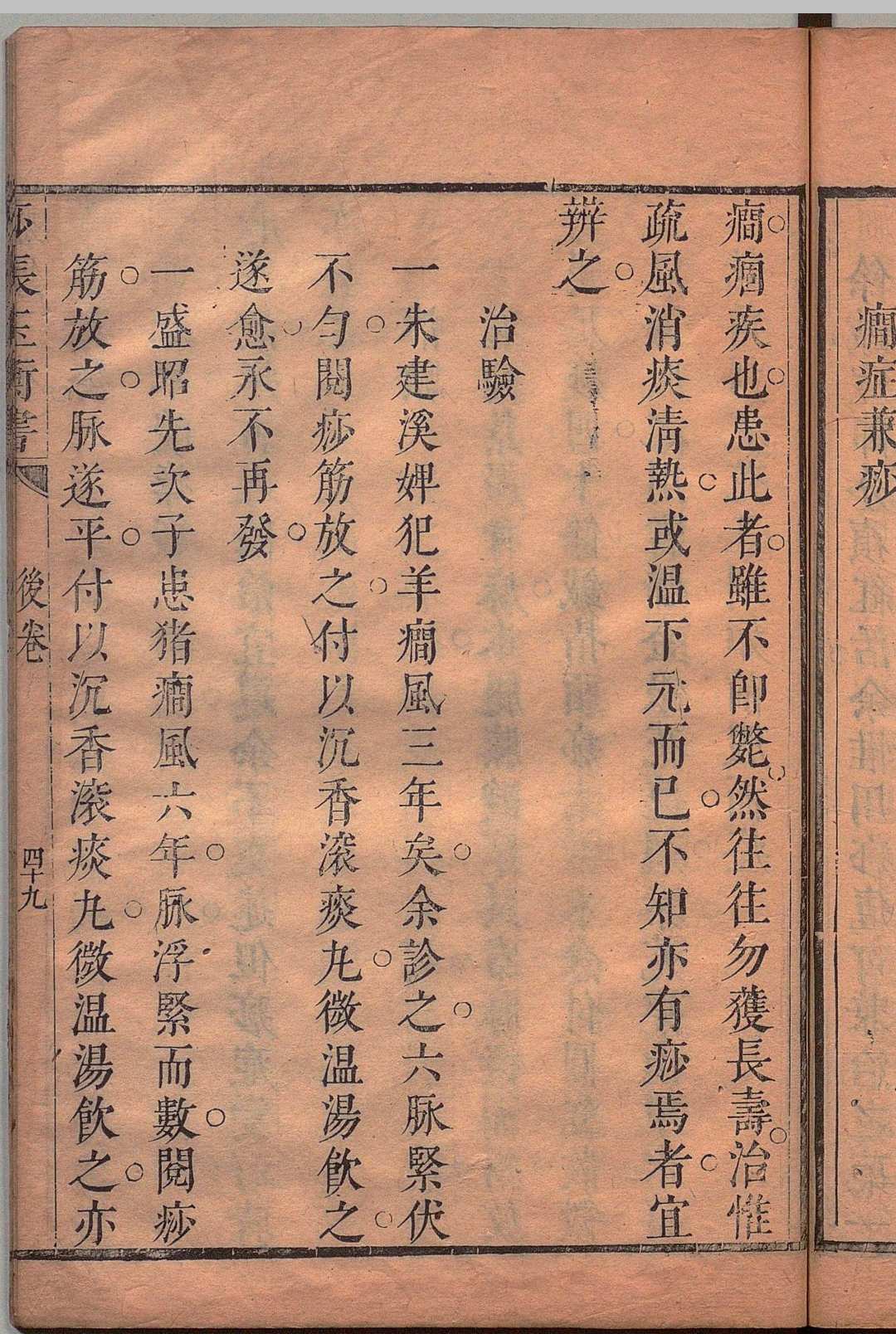 图片[9]中华古籍网-专注古书收集痧胀玉衡书 ３卷 后１卷  郭志邃,清康熙14年中华古籍网-专注古书收集中华古籍网