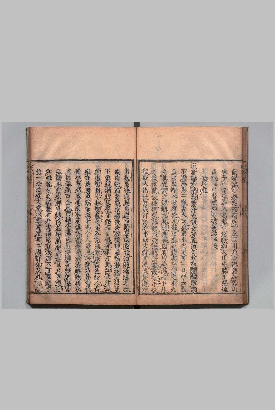 图片[7]中华古籍网-专注古书收集新刻诸症弁疑 ６卷 吴球（明）刊本 ,正保3年中华古籍网-专注古书收集中华古籍网