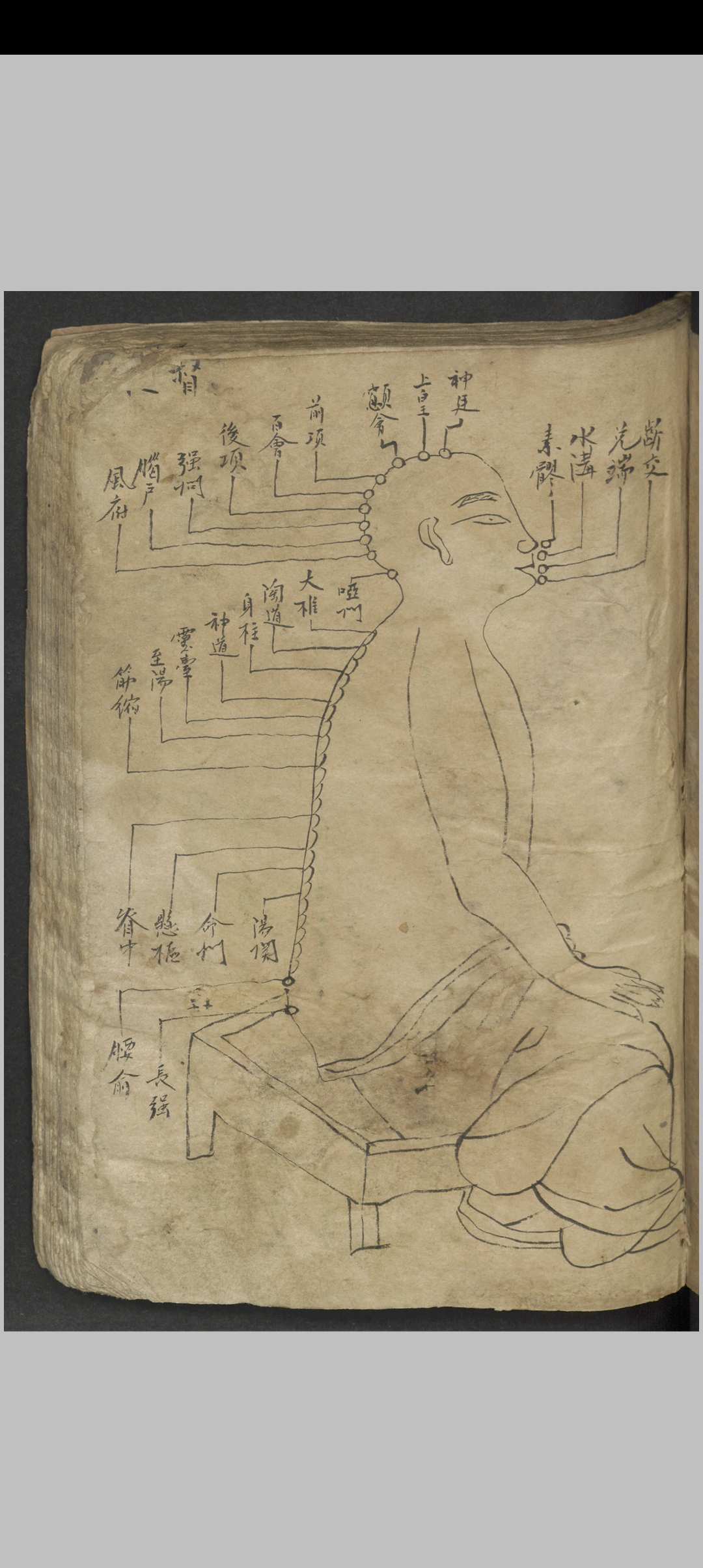 图片[3]中华古籍网-专注古书收集针灸大成节抄 , 1800中华古籍网-专注古书收集中华古籍网