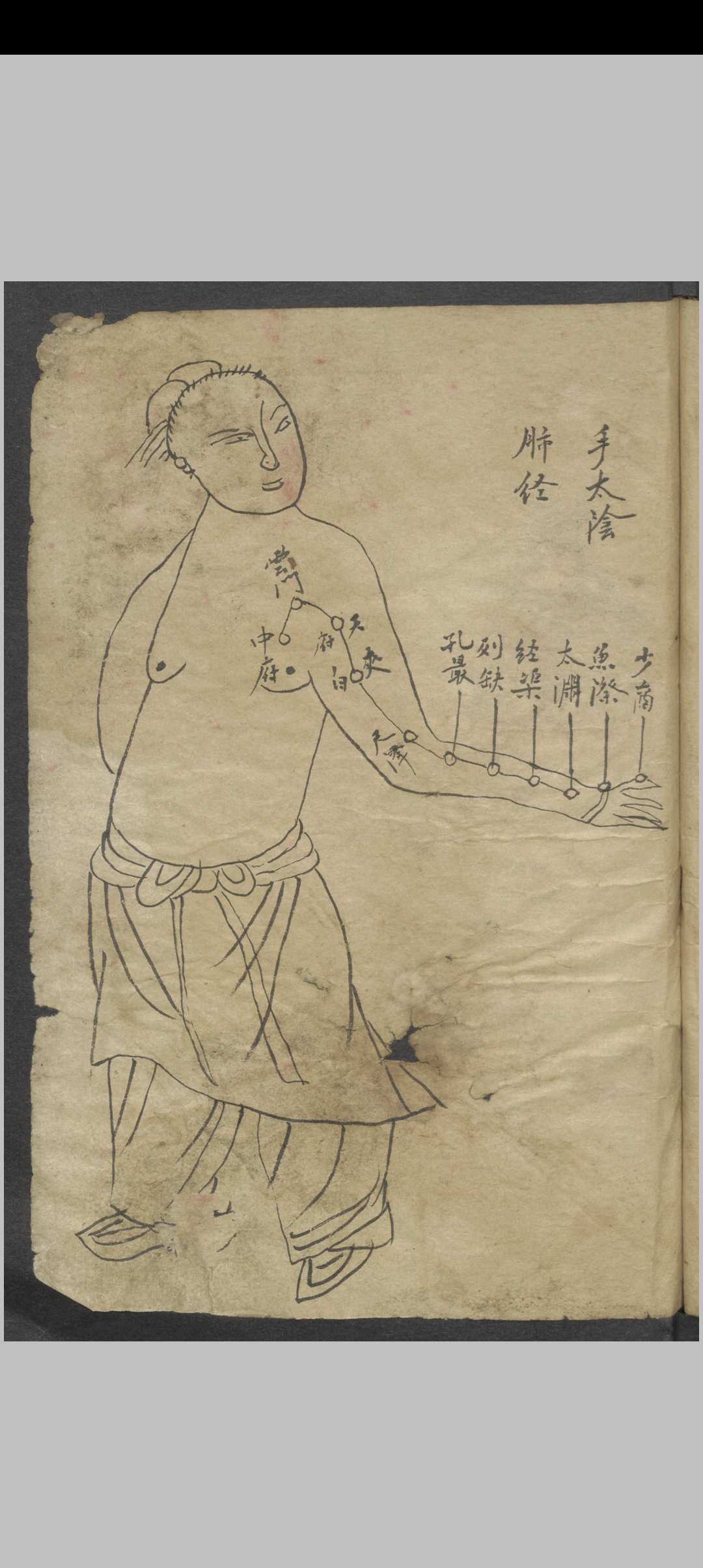 图片[6]中华古籍网-专注古书收集针灸大成节抄 , 1800中华古籍网-专注古书收集中华古籍网