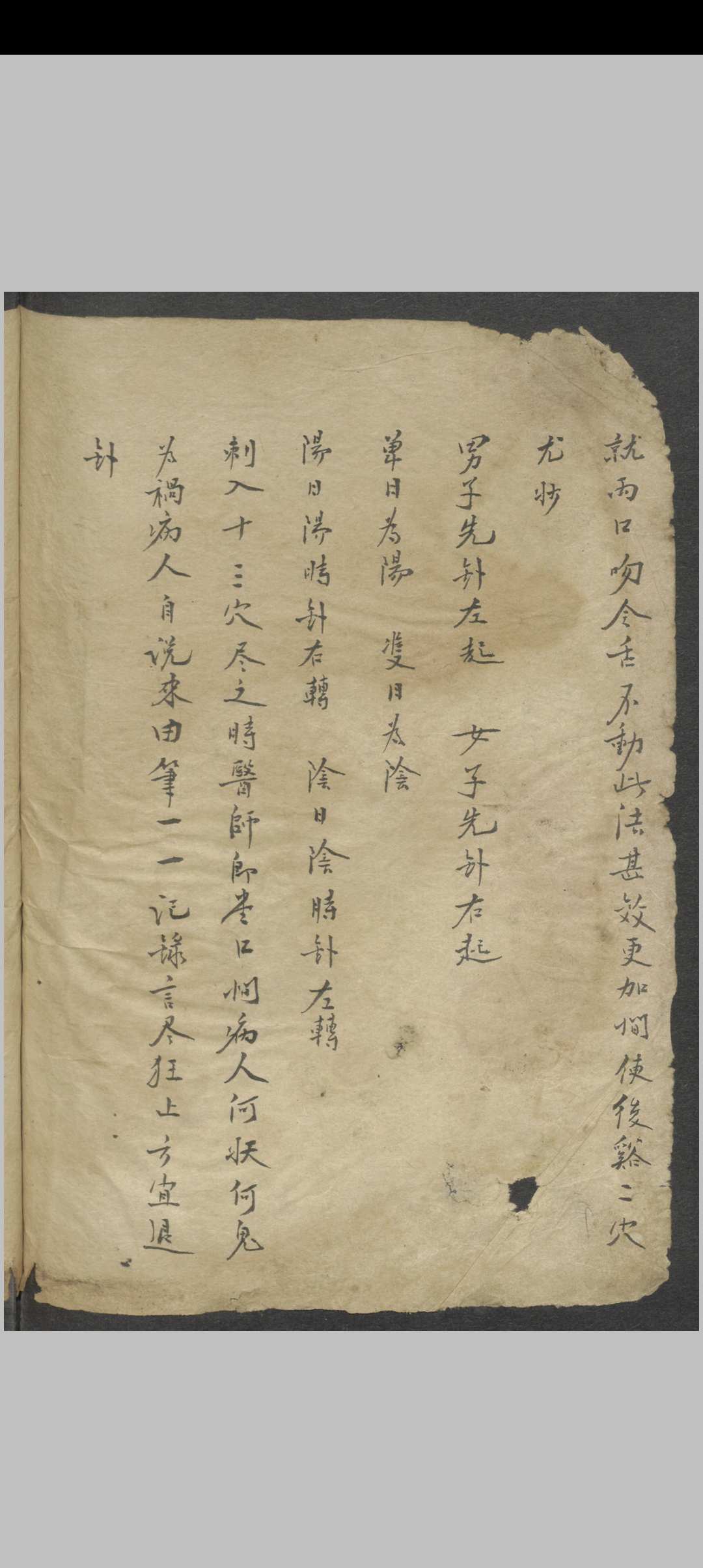 图片[16]中华古籍网-专注古书收集针灸大成节抄 , 1800中华古籍网-专注古书收集中华古籍网