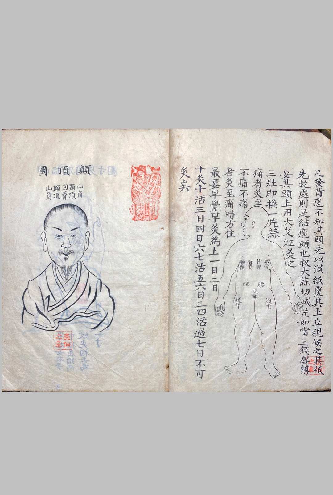 图片[6]中华古籍网-专注古书收集明堂孔穴图中华古籍网-专注古书收集中华古籍网