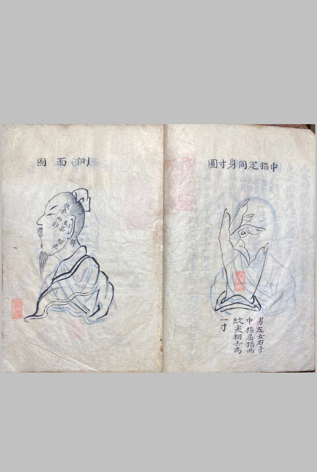图片[10]中华古籍网-专注古书收集明堂孔穴图中华古籍网-专注古书收集中华古籍网