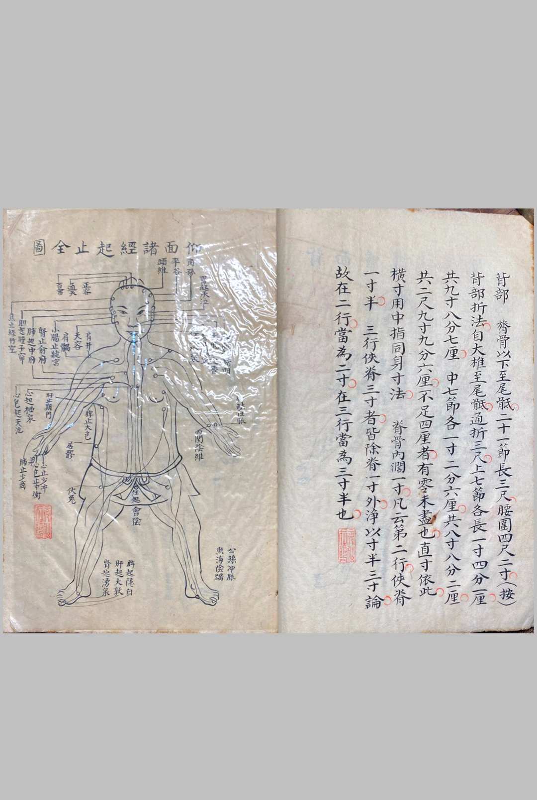 图片[13]中华古籍网-专注古书收集明堂孔穴图中华古籍网-专注古书收集中华古籍网