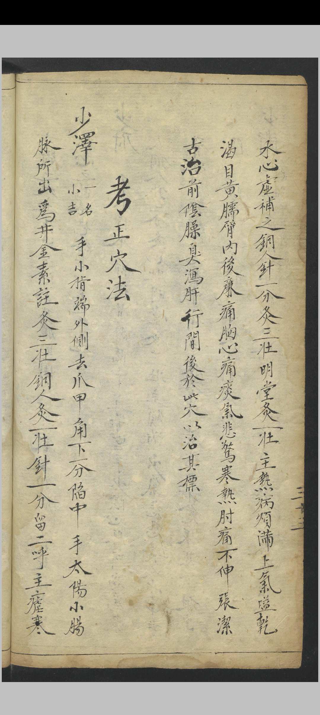 图片[12]中华古籍网-专注古书收集针穴考正穴法 , 1900中华古籍网-专注古书收集中华古籍网