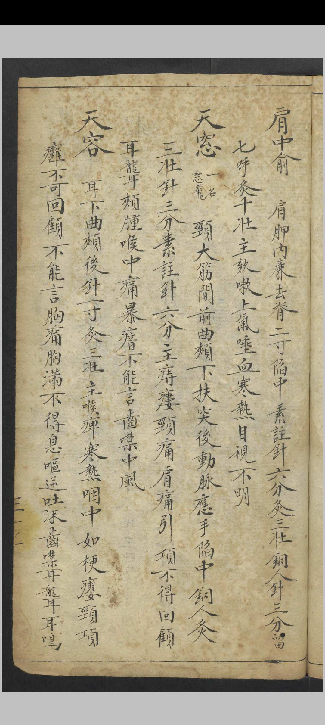 图片[10]中华古籍网-专注古书收集针穴考正穴法 , 1900中华古籍网-专注古书收集中华古籍网