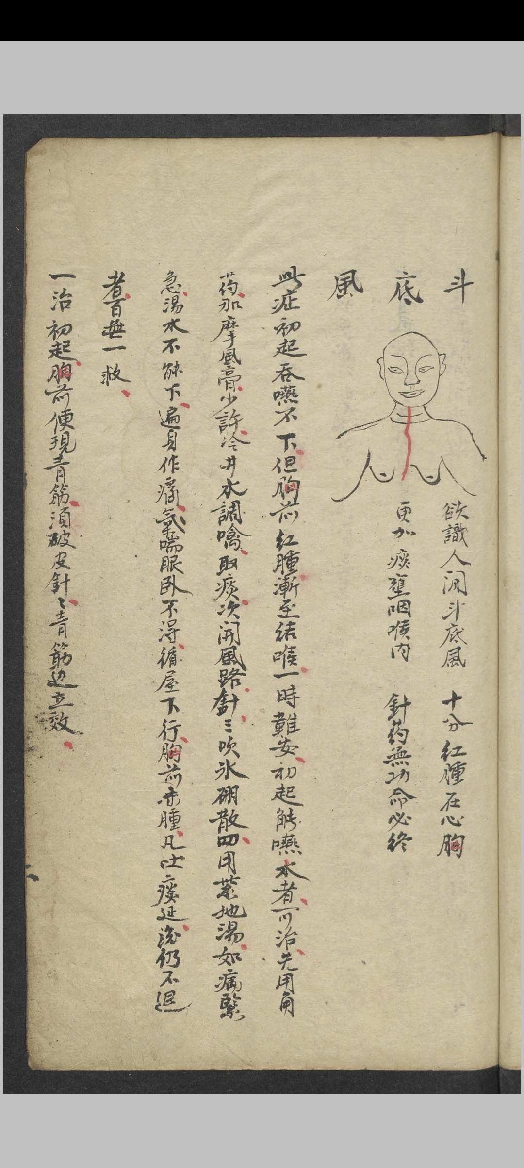 图片[6]中华古籍网-专注古书收集郑梅涧 重楼玉钥 , 1800（医）中华古籍网-专注古书收集中华古籍网