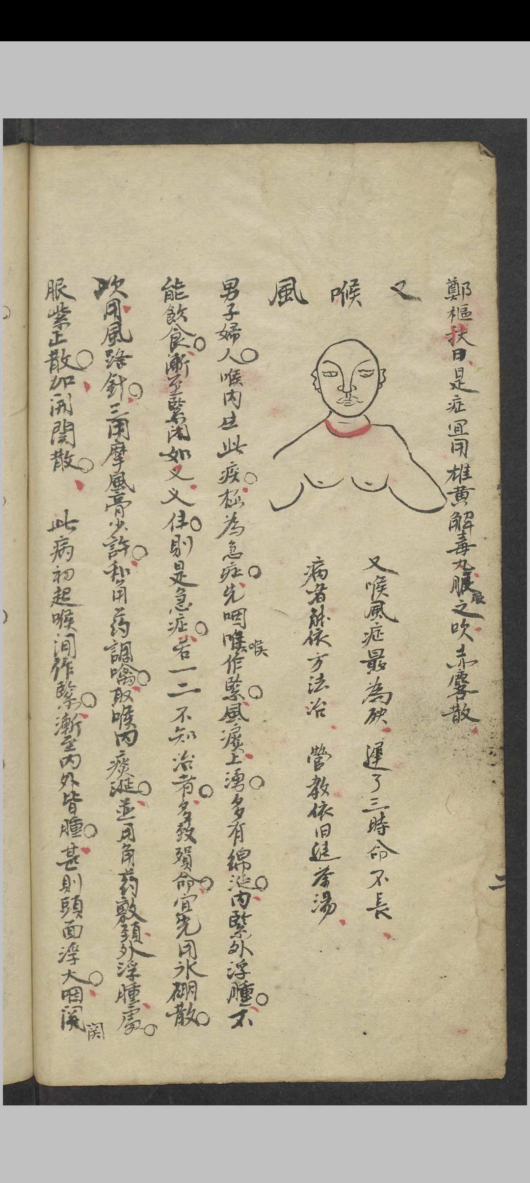 图片[4]中华古籍网-专注古书收集郑梅涧 重楼玉钥 , 1800（医）中华古籍网-专注古书收集中华古籍网