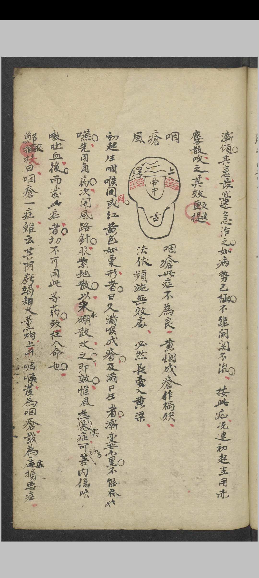 图片[2]中华古籍网-专注古书收集郑梅涧 重楼玉钥 , 1800（医）中华古籍网-专注古书收集中华古籍网
