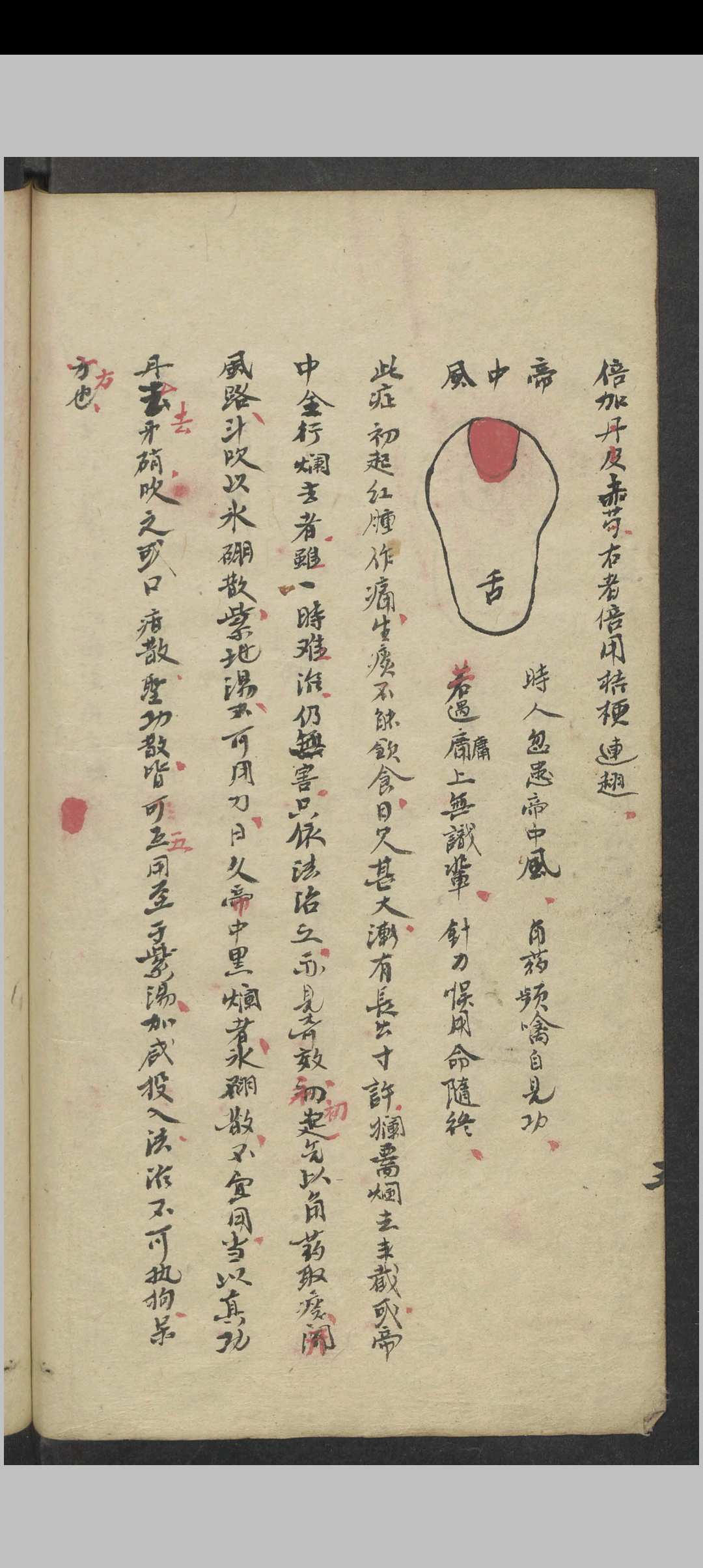 图片[3]中华古籍网-专注古书收集郑梅涧 重楼玉钥 , 1800（医）中华古籍网-专注古书收集中华古籍网
