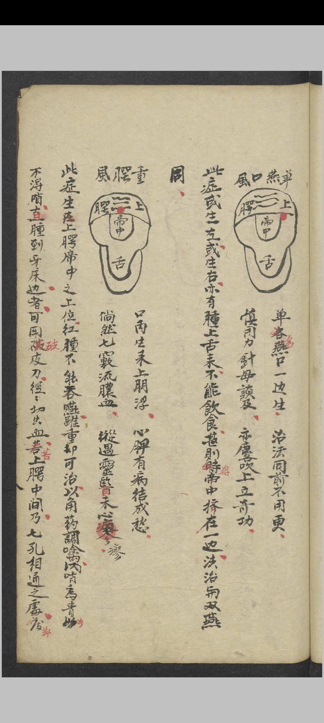 图片[7]中华古籍网-专注古书收集郑梅涧 重楼玉钥 , 1800（医）中华古籍网-专注古书收集中华古籍网