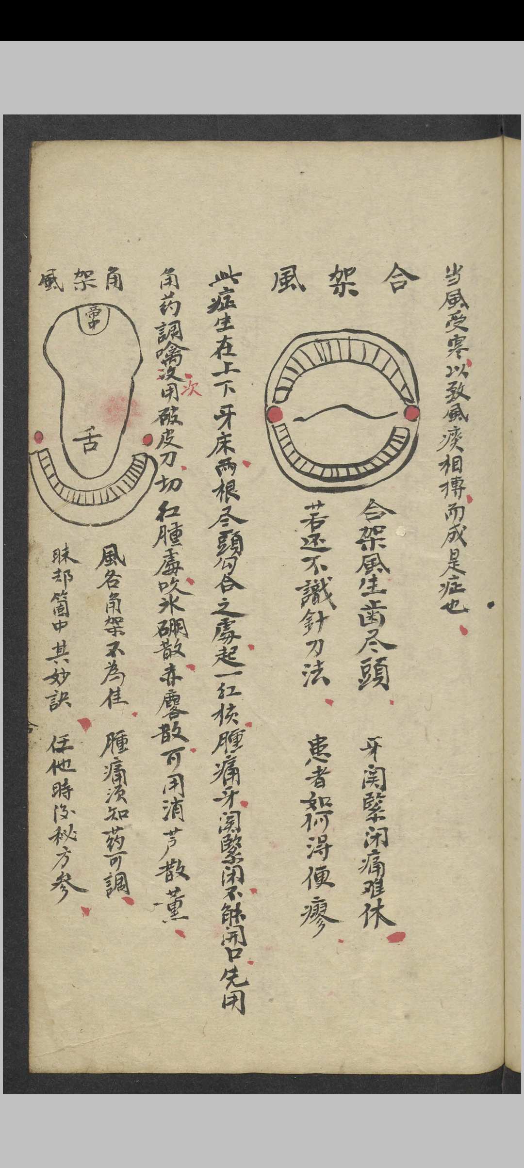 图片[5]中华古籍网-专注古书收集郑梅涧 重楼玉钥 , 1800（医）中华古籍网-专注古书收集中华古籍网