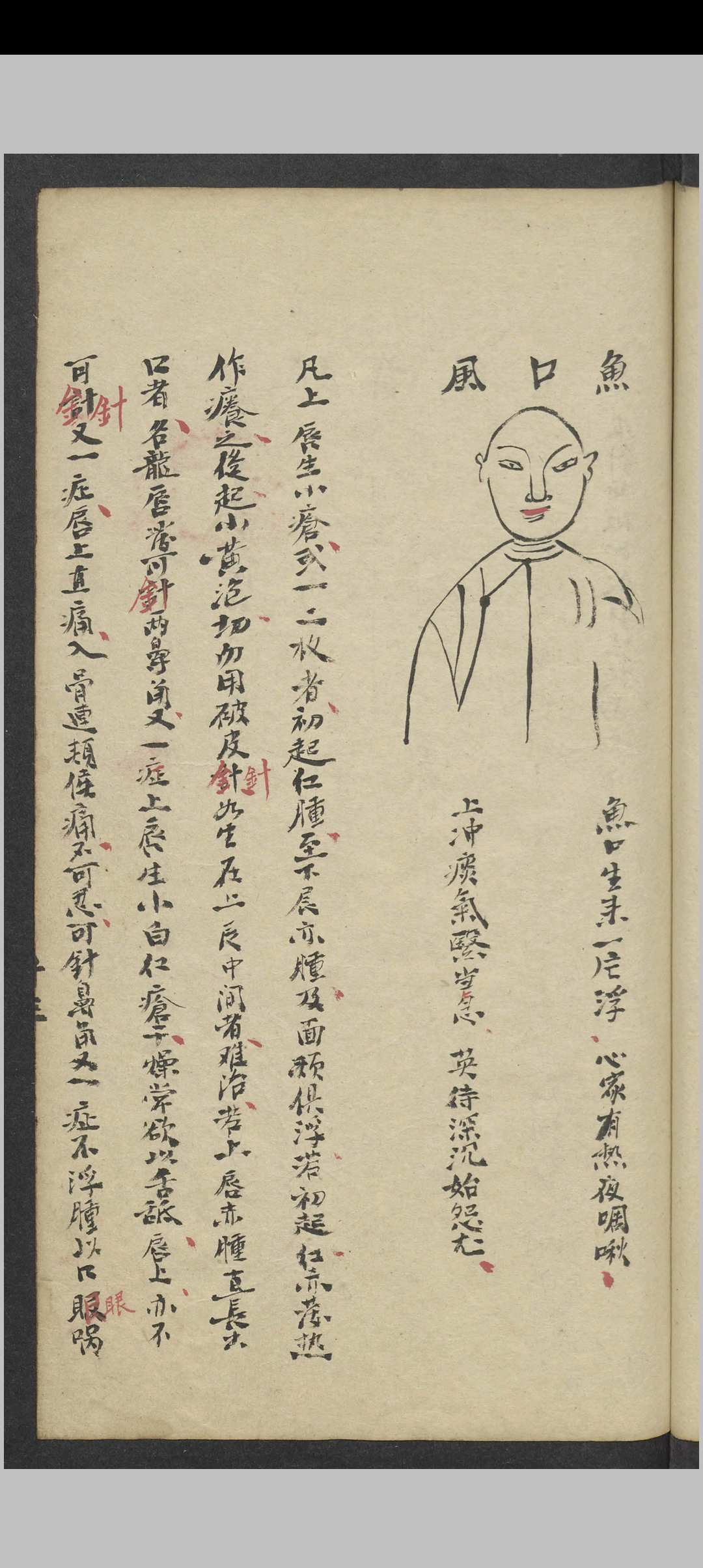 图片[14]中华古籍网-专注古书收集郑梅涧 重楼玉钥 , 1800（医）中华古籍网-专注古书收集中华古籍网