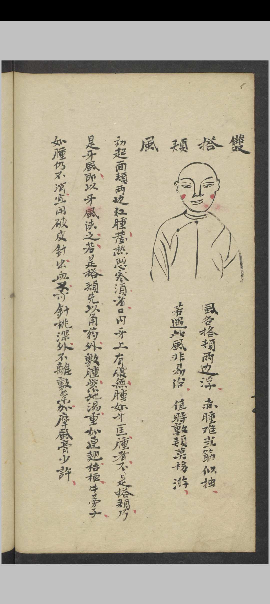 图片[10]中华古籍网-专注古书收集郑梅涧 重楼玉钥 , 1800（医）中华古籍网-专注古书收集中华古籍网