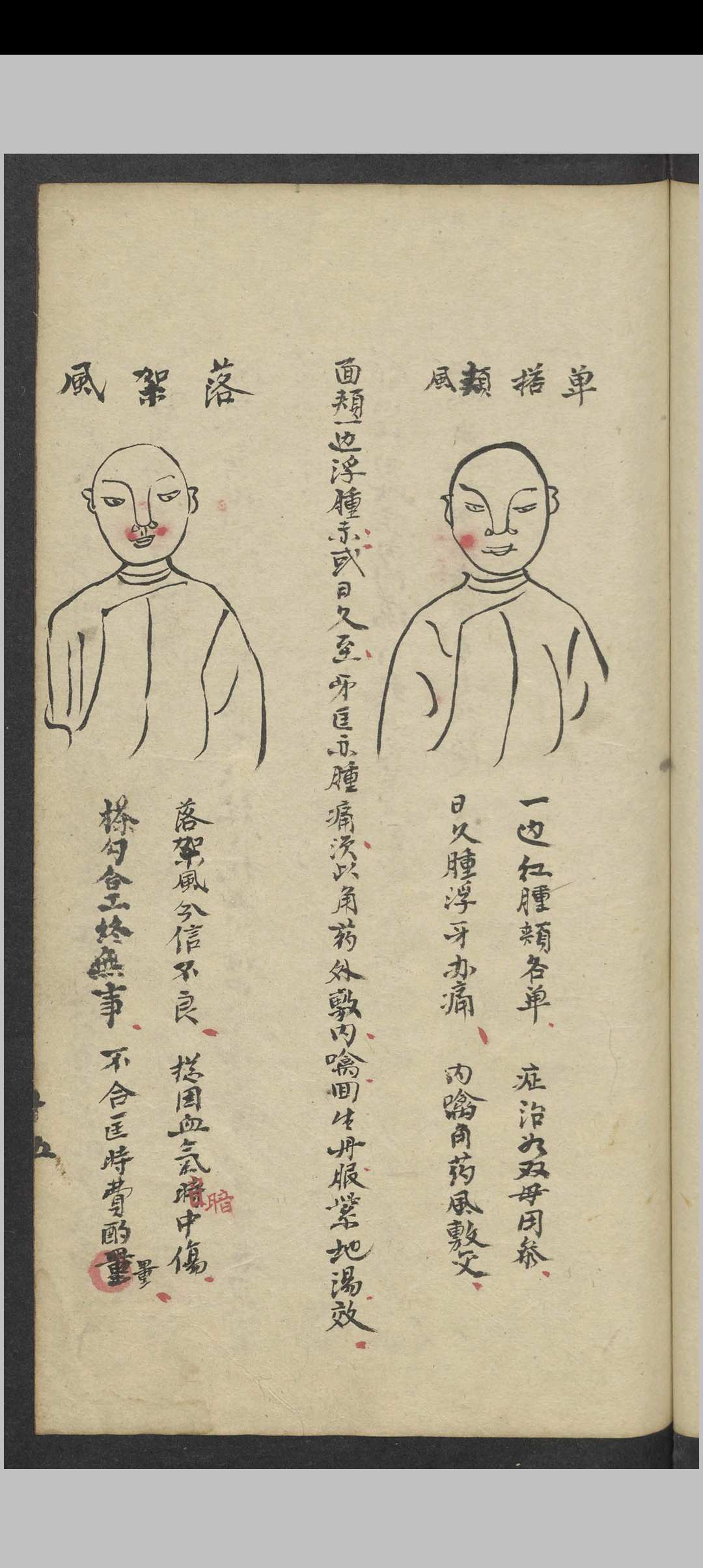图片[8]中华古籍网-专注古书收集郑梅涧 重楼玉钥 , 1800（医）中华古籍网-专注古书收集中华古籍网