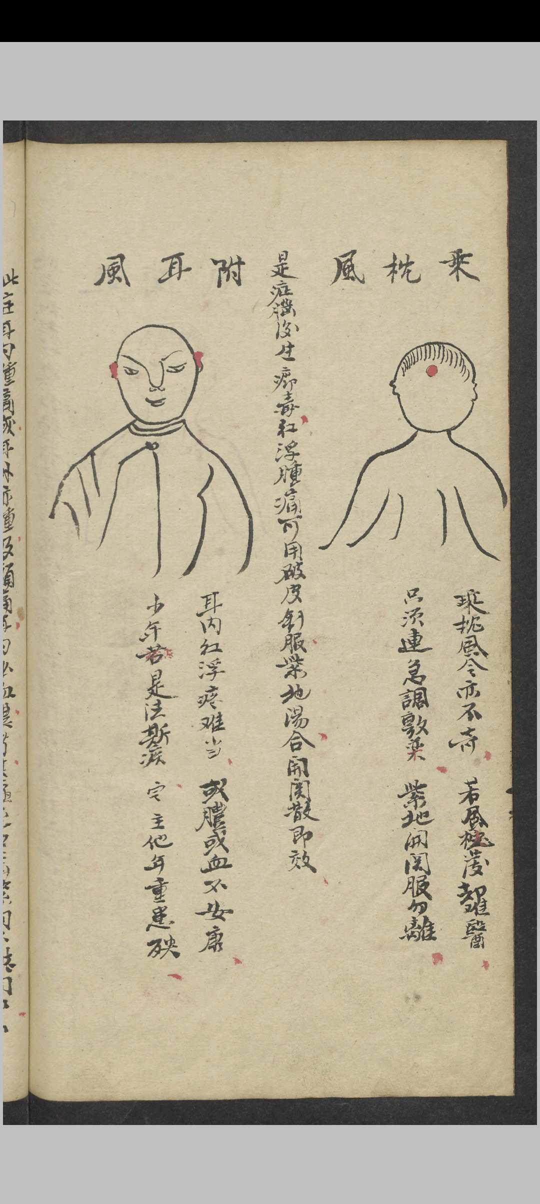 图片[9]中华古籍网-专注古书收集郑梅涧 重楼玉钥 , 1800（医）中华古籍网-专注古书收集中华古籍网
