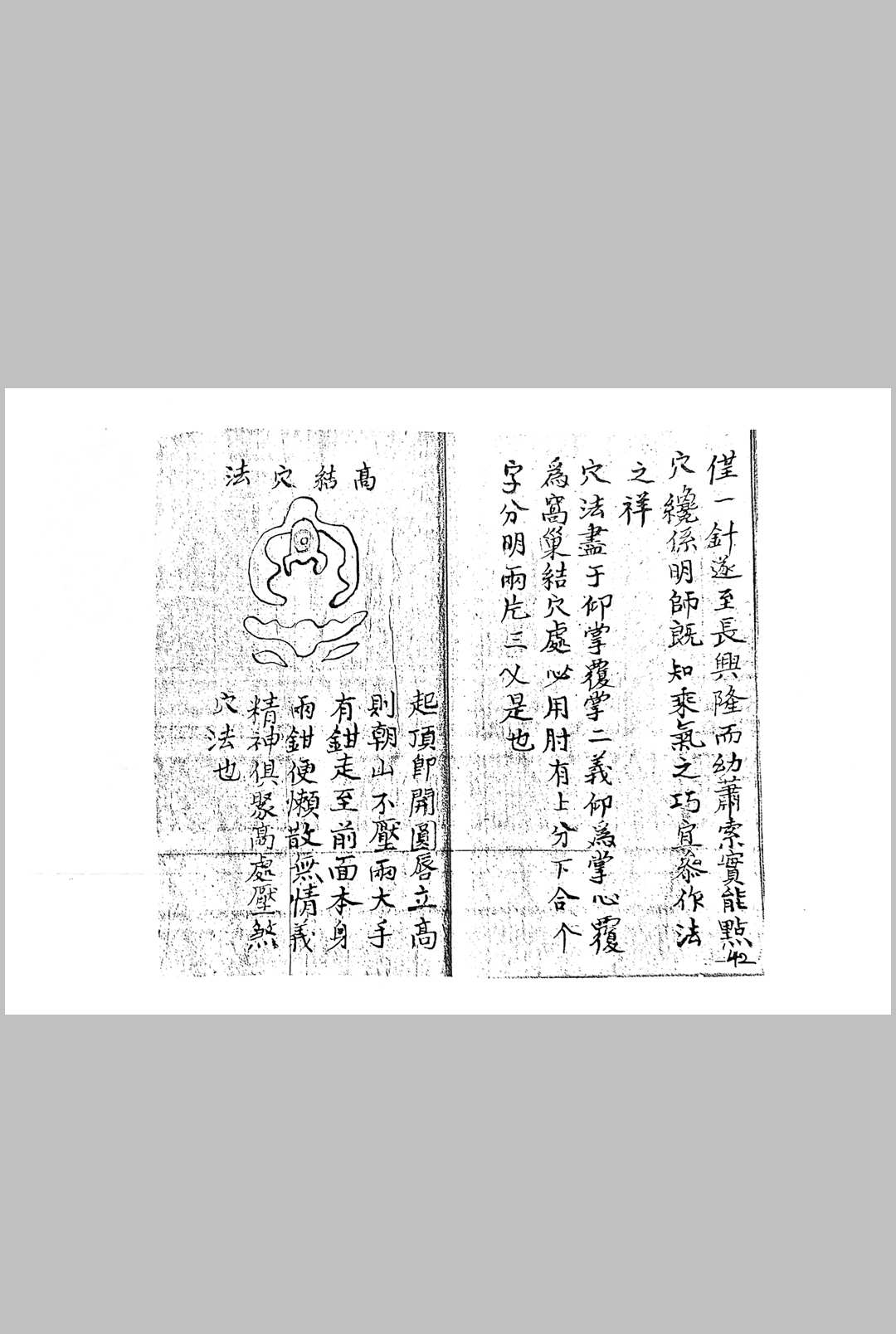 图片[11]中华古籍网-专注古书收集高山点穴法中华古籍网-专注古书收集中华古籍网