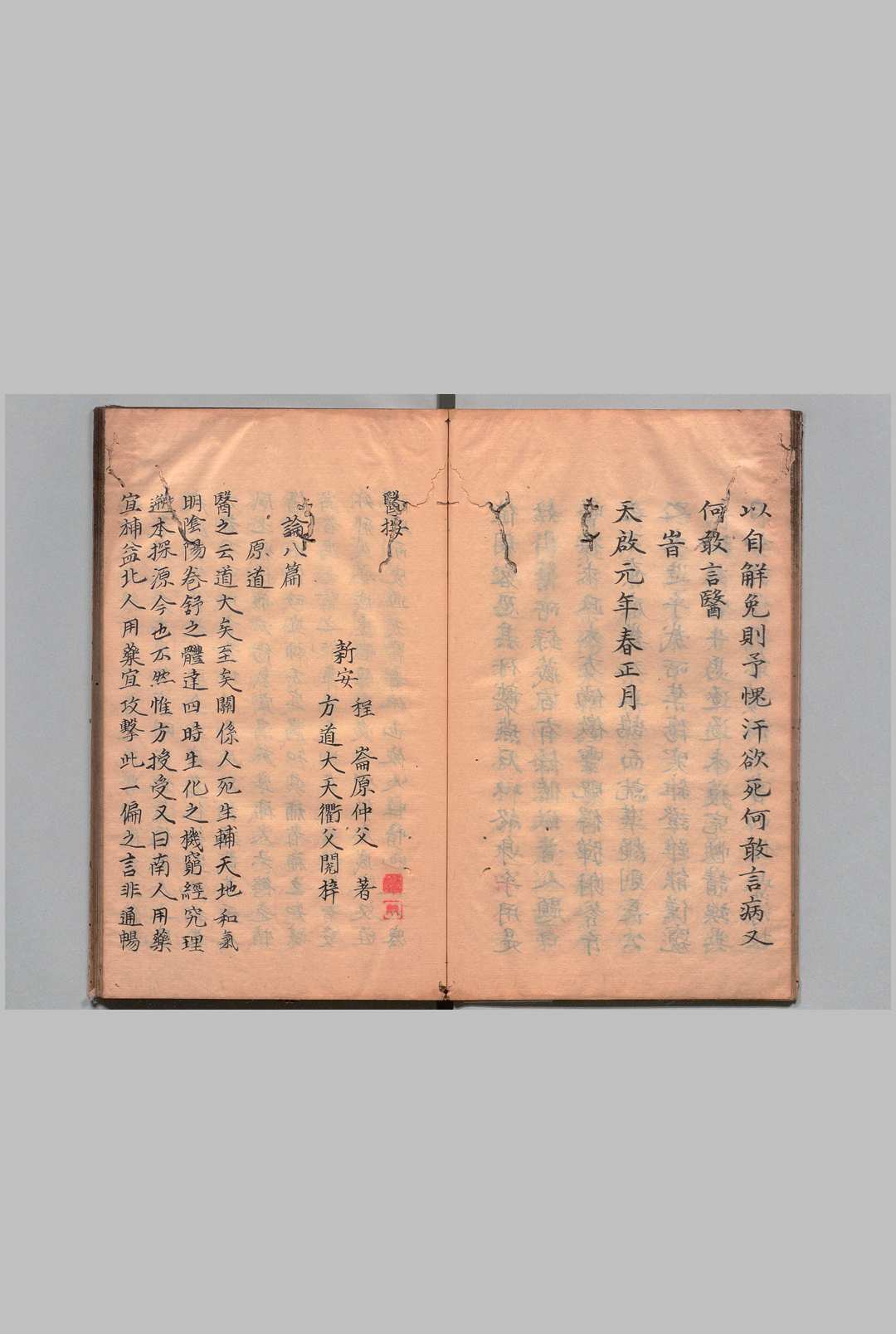 图片[3]中华古籍网-专注古书收集医按 程星海医案 程崙（明）写本 ,江户中华古籍网-专注古书收集中华古籍网