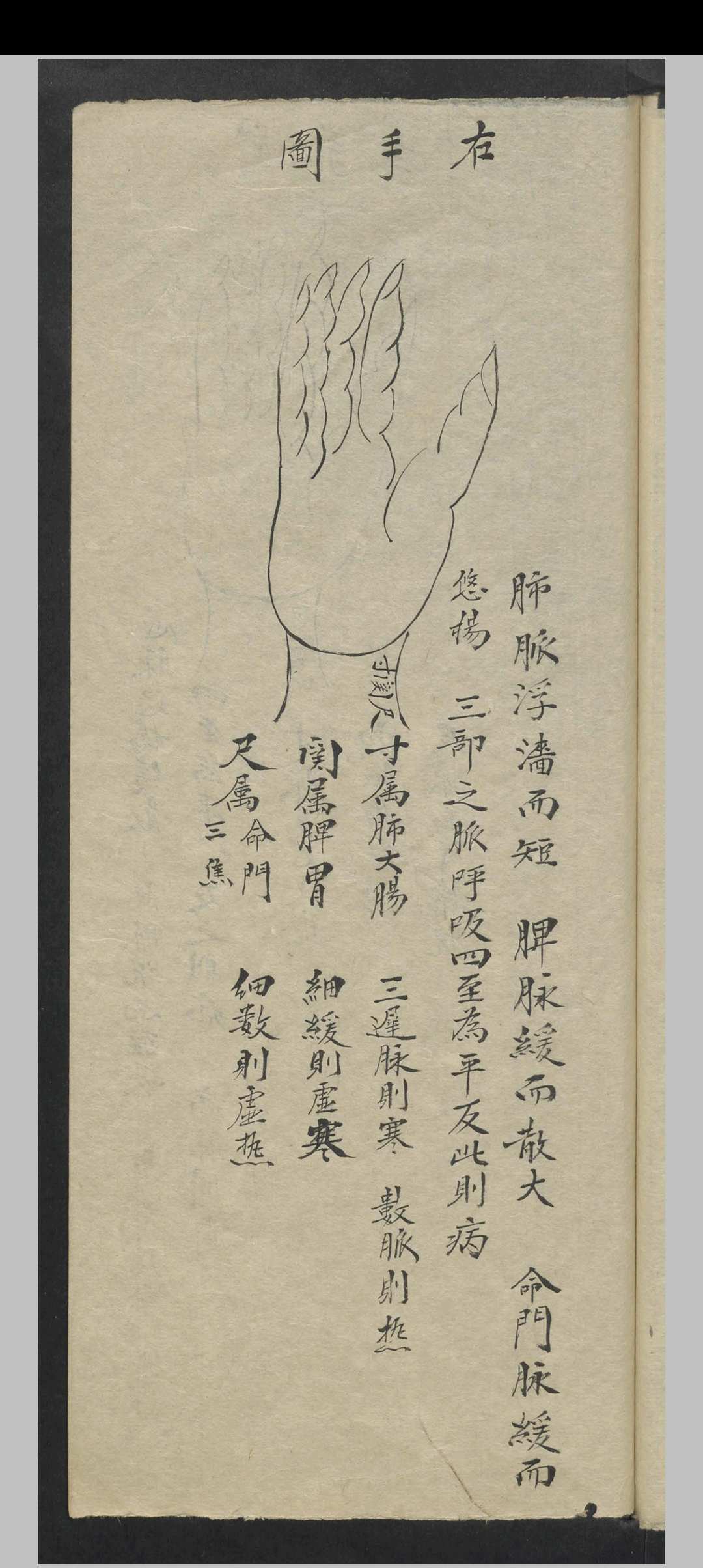 图片[15]中华古籍网-专注古书收集张宗良 图像咽喉科 , 1843中华古籍网-专注古书收集中华古籍网