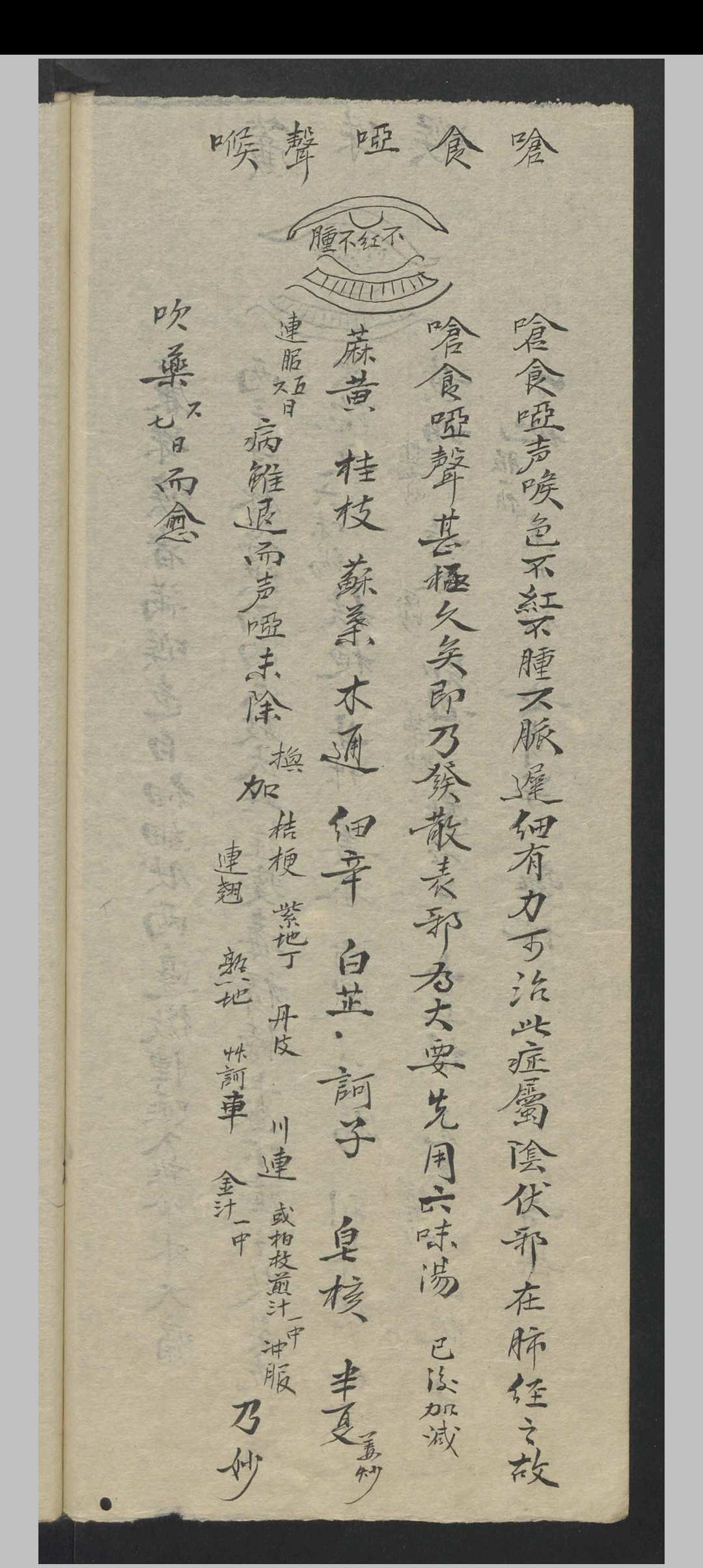 图片[13]中华古籍网-专注古书收集张宗良 图像咽喉科 , 1843中华古籍网-专注古书收集中华古籍网