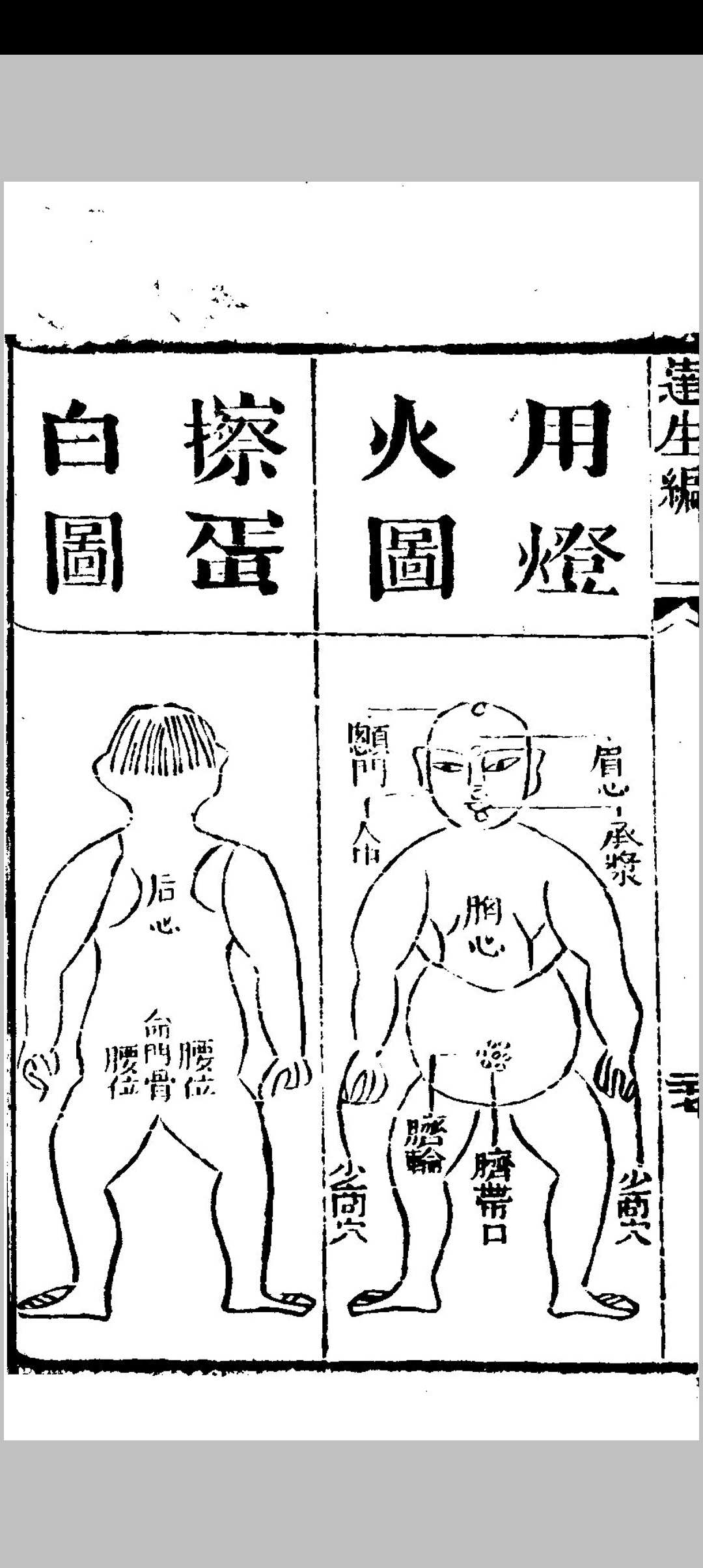 图片[12]中华古籍网-专注古书收集达生 遂生福幼合编中华古籍网-专注古书收集中华古籍网