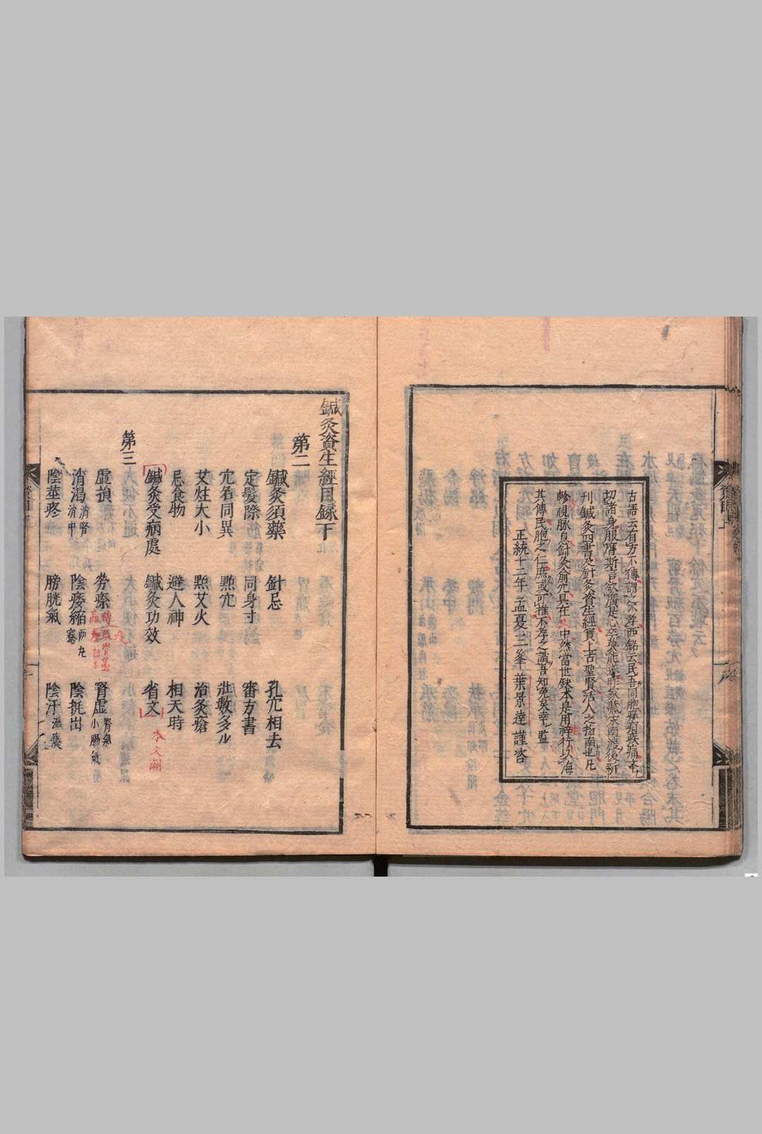 图片[4]中华古籍网-专注古书收集针灸资生经 ７卷 目２卷 王执中（宋）刊本 ,宽文9年中华古籍网-专注古书收集中华古籍网