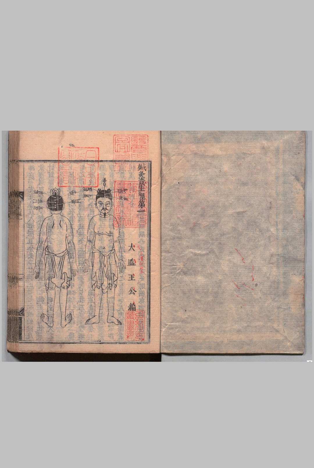 图片[6]中华古籍网-专注古书收集针灸资生经 ７卷 目２卷 王执中（宋）刊本 ,宽文9年中华古籍网-专注古书收集中华古籍网