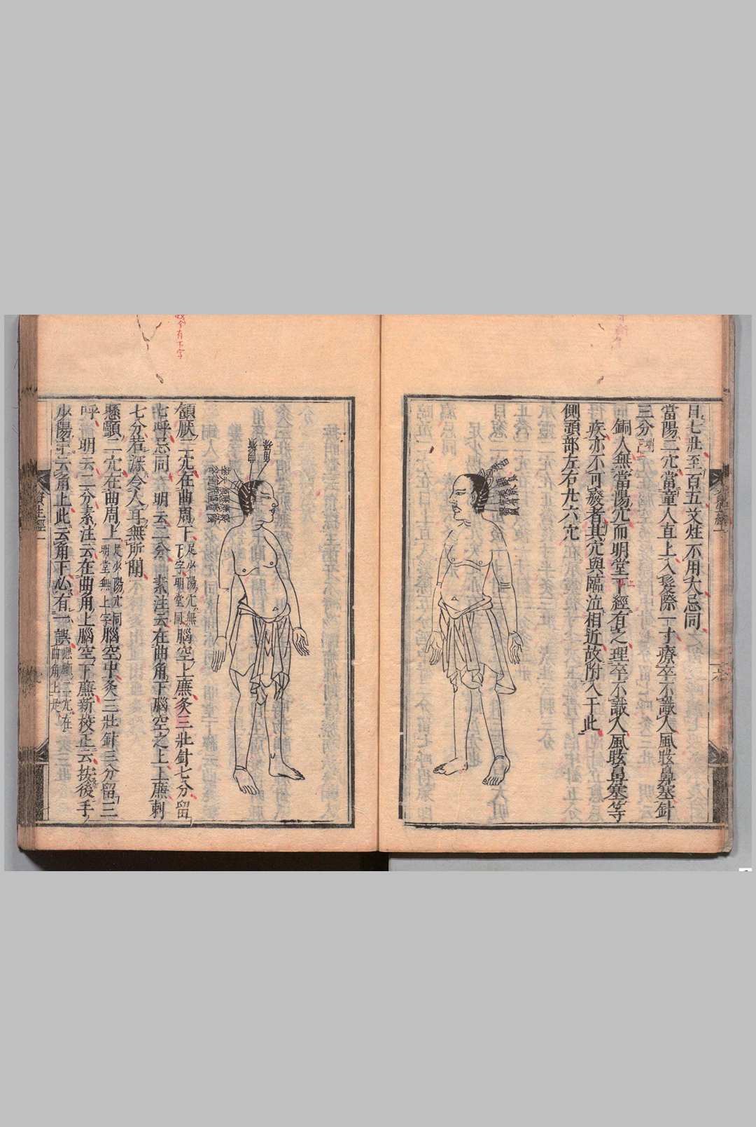 图片[7]中华古籍网-专注古书收集针灸资生经 ７卷 目２卷 王执中（宋）刊本 ,宽文9年中华古籍网-专注古书收集中华古籍网