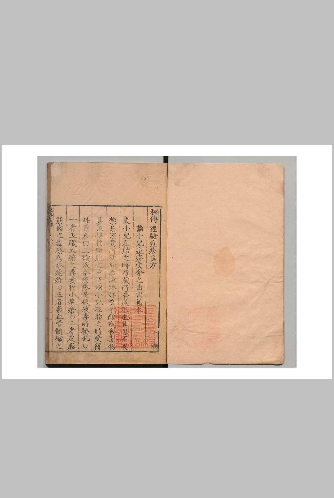 秘传经验痘疹良方 ３卷 明刊本中华古籍网-专注古书收集中华古籍网