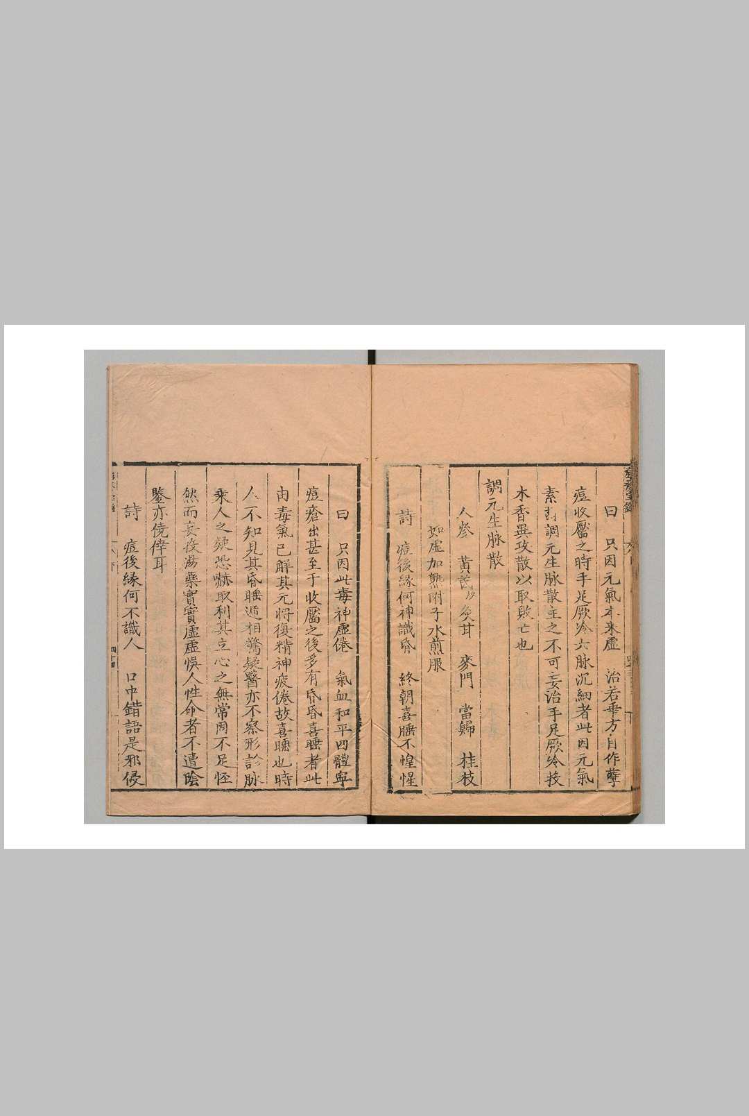 图片[5]中华古籍网-专注古书收集秘传经验痘疹良方 ３卷 明刊本中华古籍网-专注古书收集中华古籍网